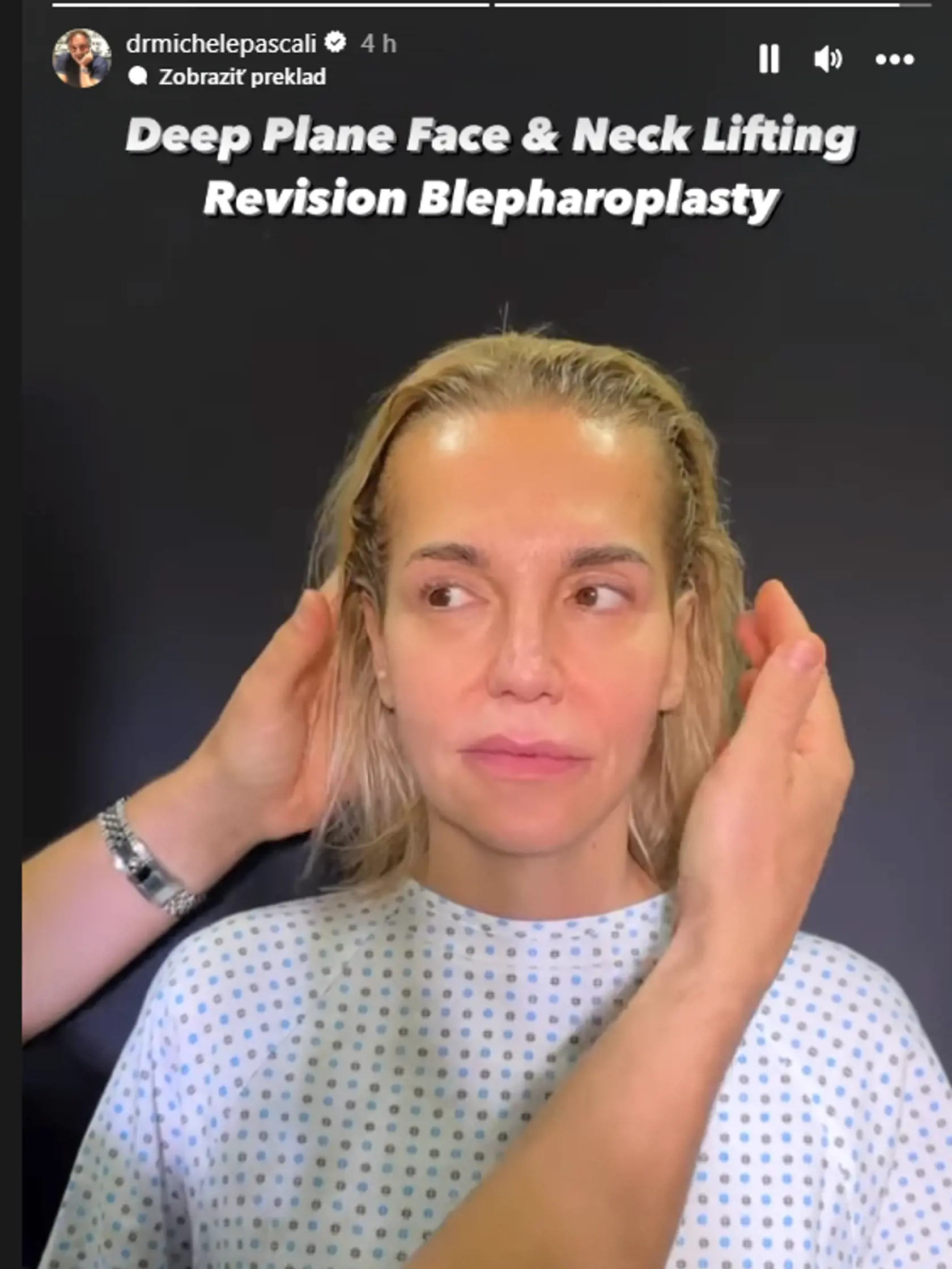 Dara Rolins u plastického chirurga v Taliansku. Video so speváčkou zverejnil samotný doktor.