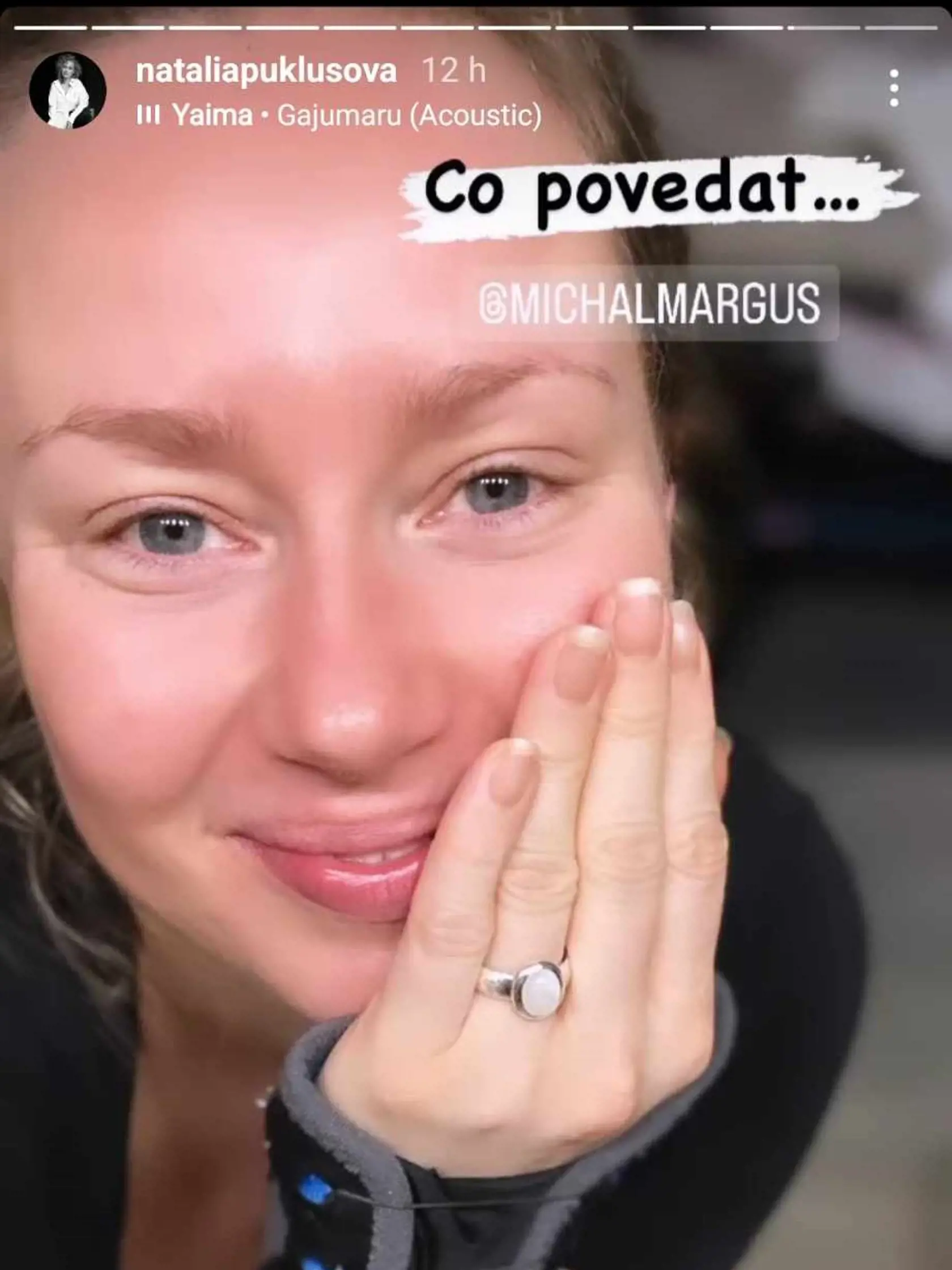 Natália so svojím snubným prsteňom