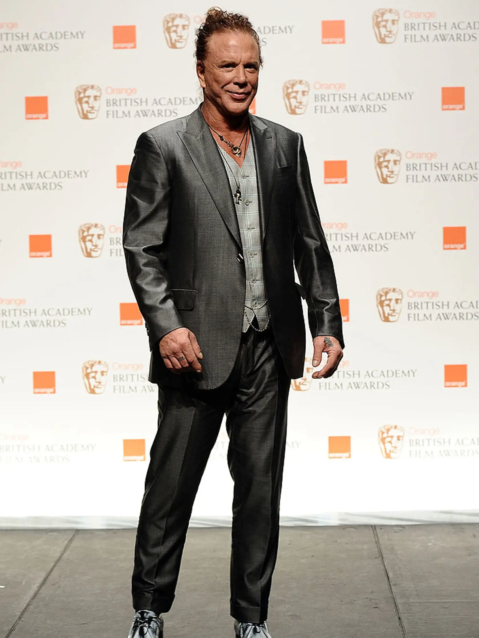 Mickey Rourke: Idol žien zmenili plastiky na nepoznanie.