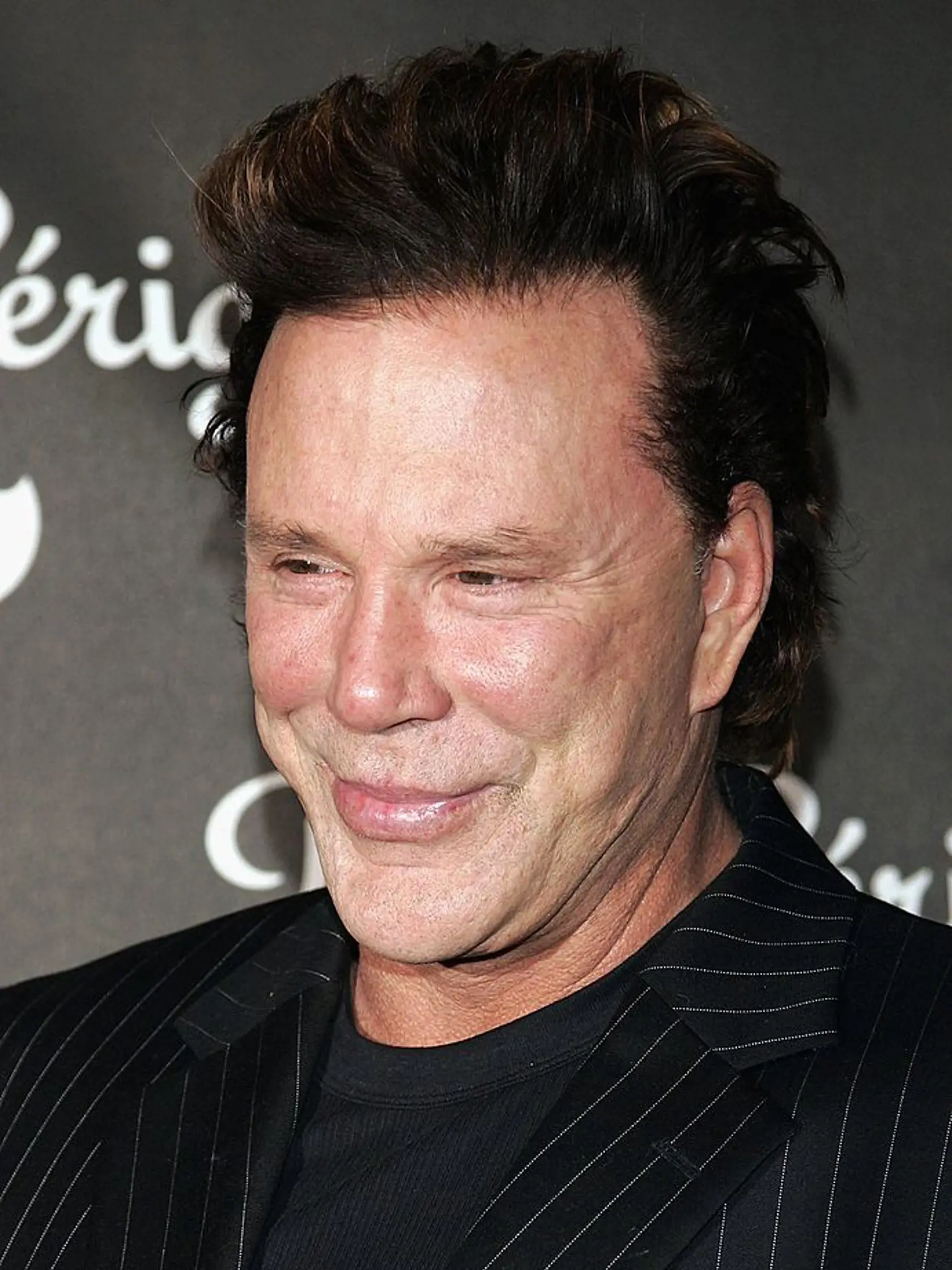 Mickey Rourke: Idol žien zmenili plastiky na nepoznanie.