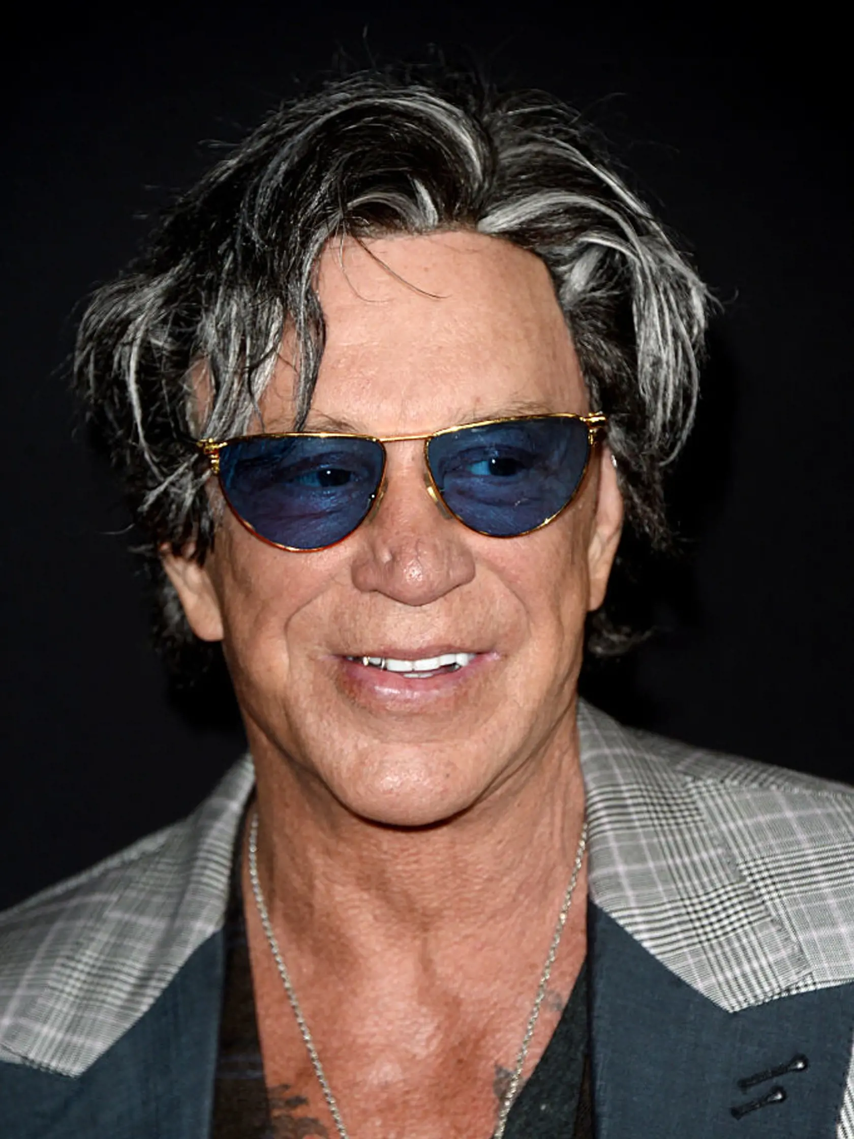 Mickey Rourke: Idol žien zmenili plastiky na nepoznanie.