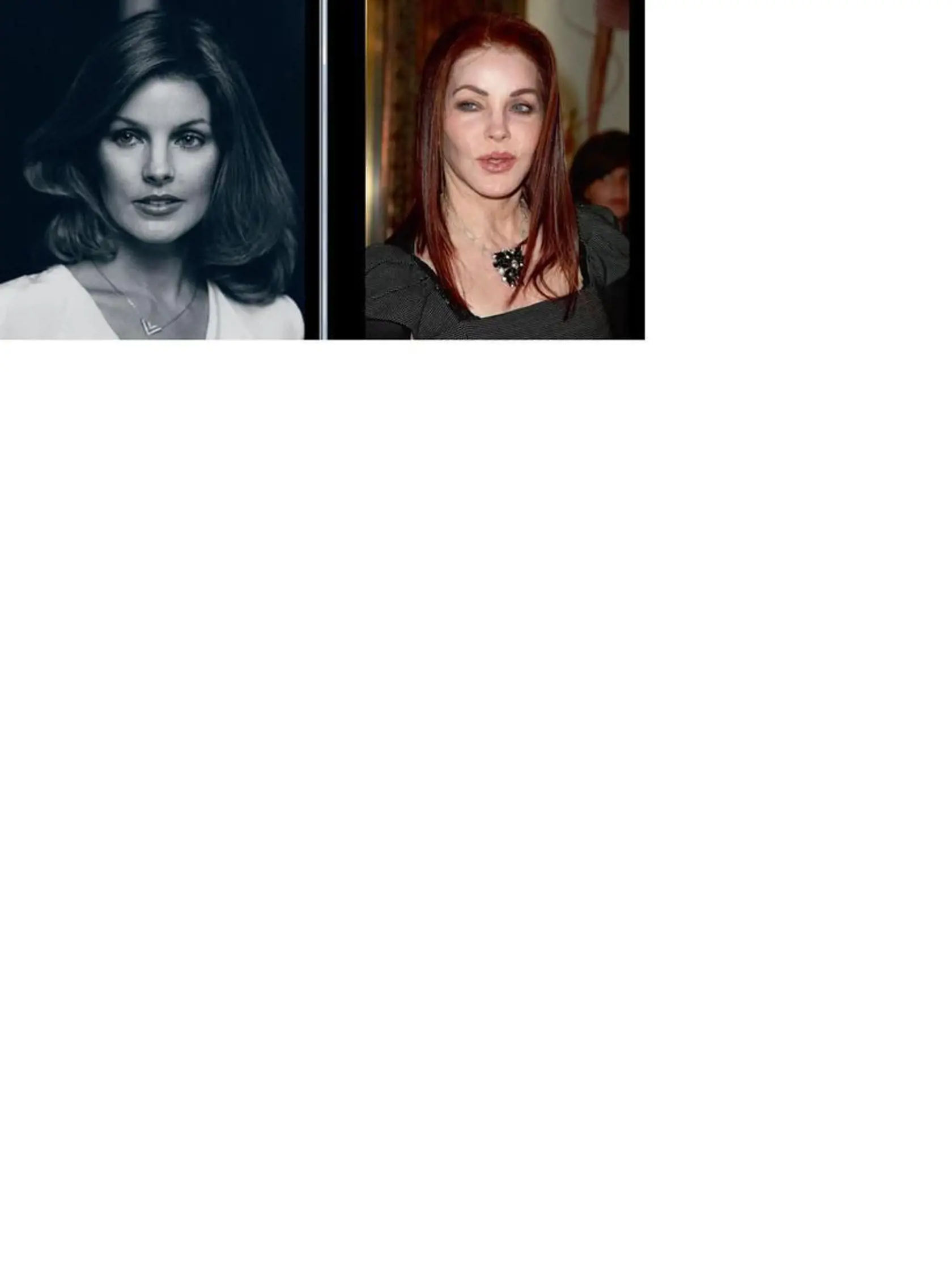Priscille Presley vstrekol Dr. Serrano silikón