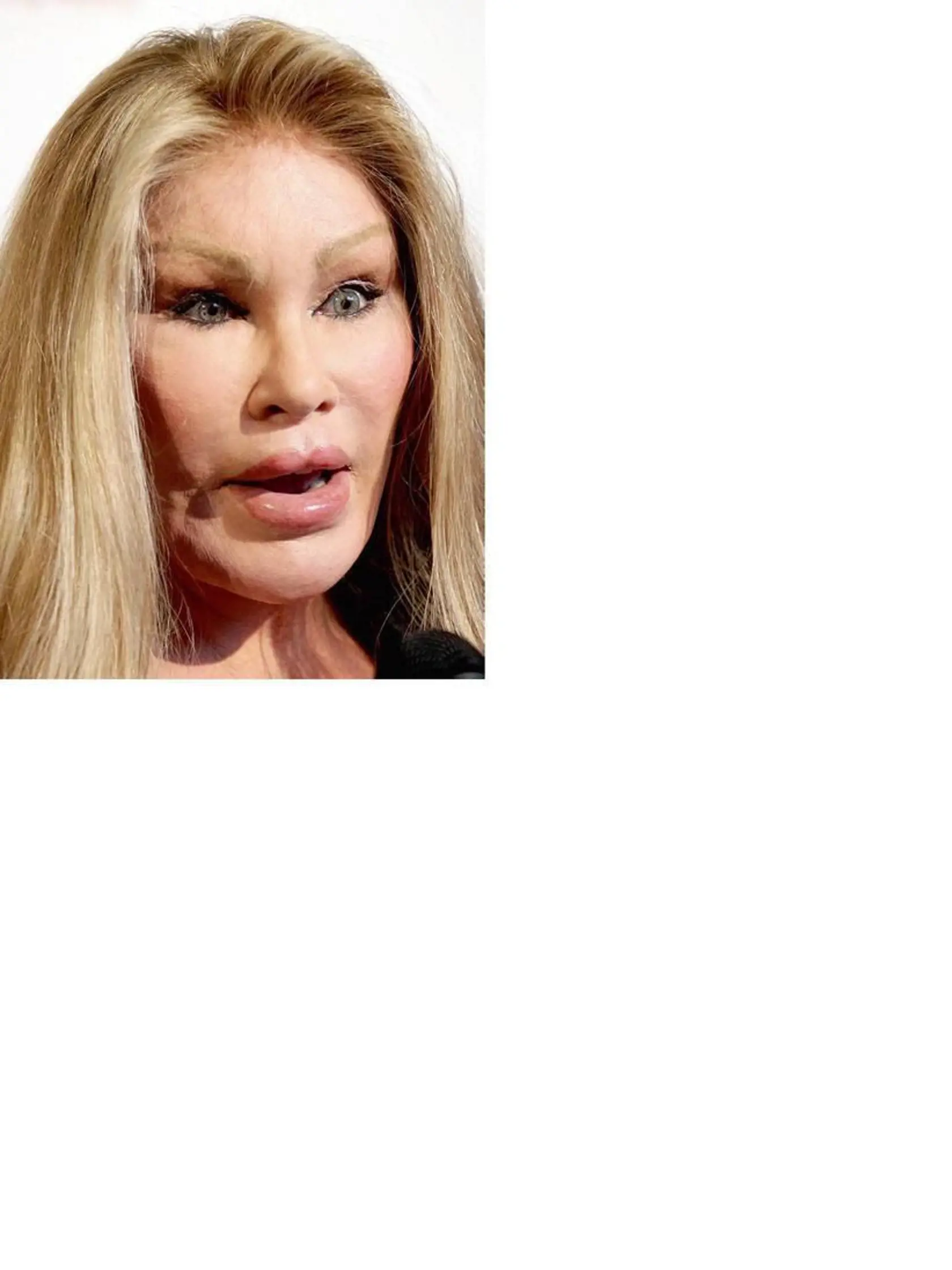 Jocelyn Wildenstein je absolútnou víťazkou