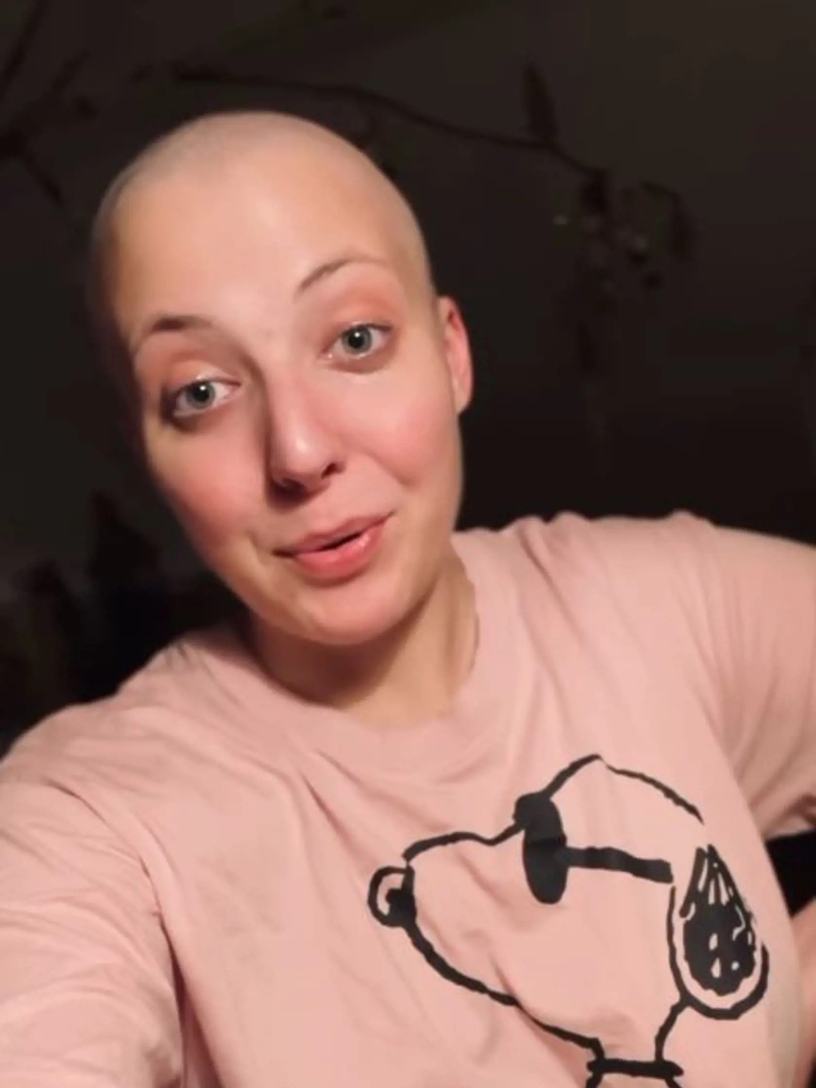 Máj 2024: Anička Slováčková je znova bez vlasov.