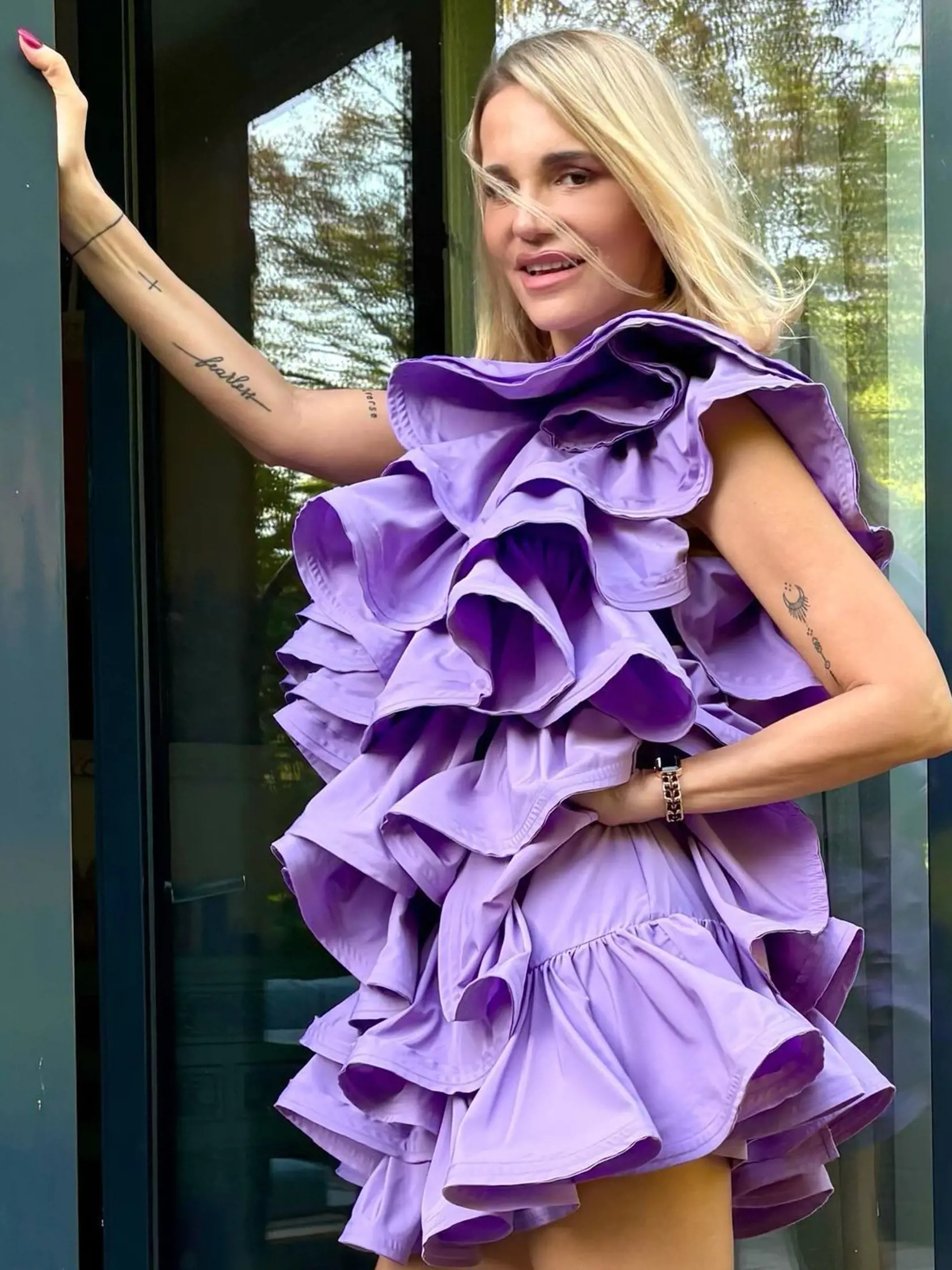 1. máj 2024: Dara Rolins zverejnila prvé foto po plastike tváre a rozpísala sa o tom, prečo išla na zákrok.