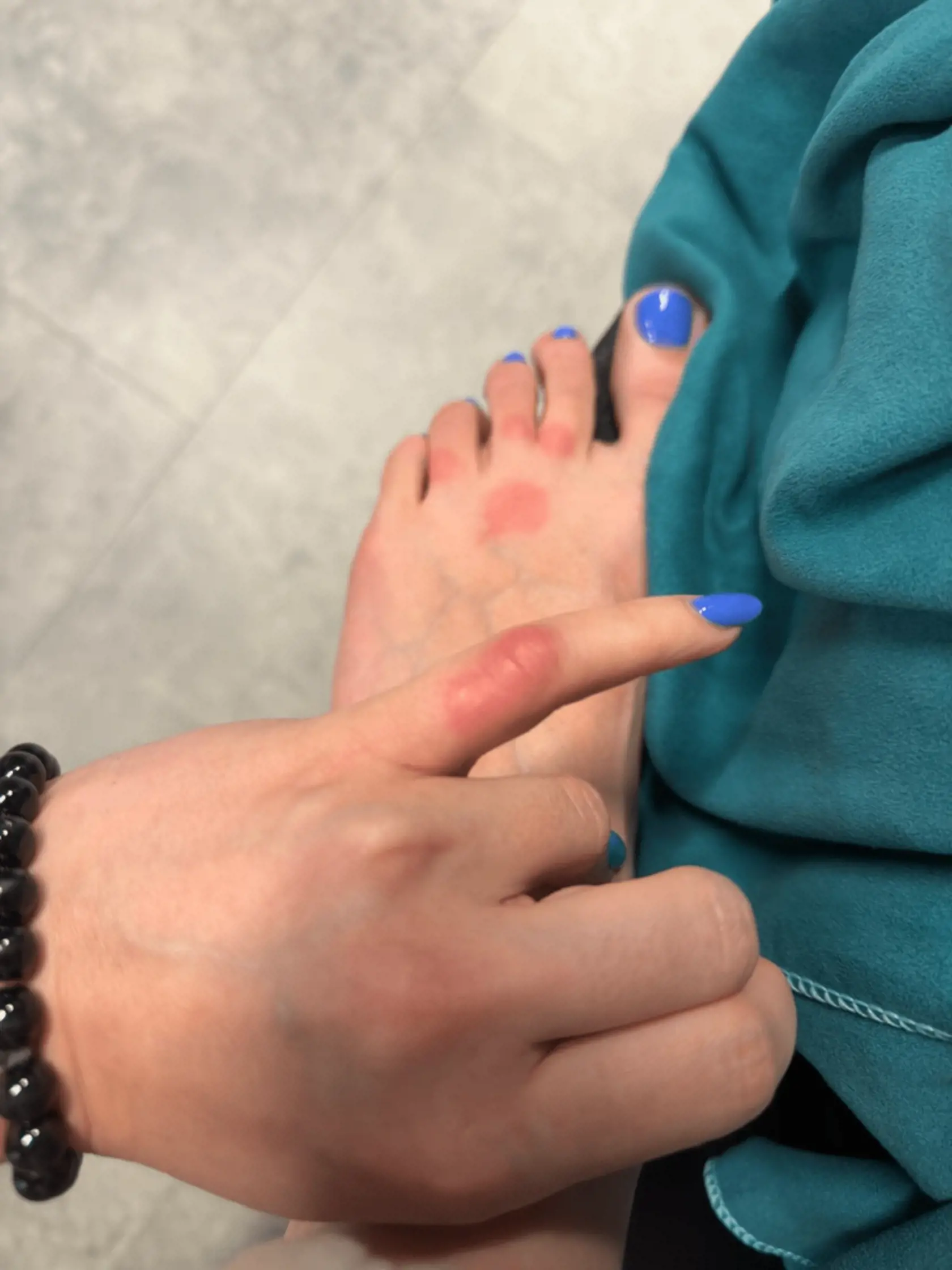 „Zhasli sme, uložili sme sa na lehátka a pozerali seriál. Asi po dvoch hodinách začala partnerku svrbieť ruka. Po zažaní svetla sme si všimli, že v oblasti paží a na nohe má veľké červené kusance,“ podelil sa s portálom nespokojný cestujúci Vojtech.