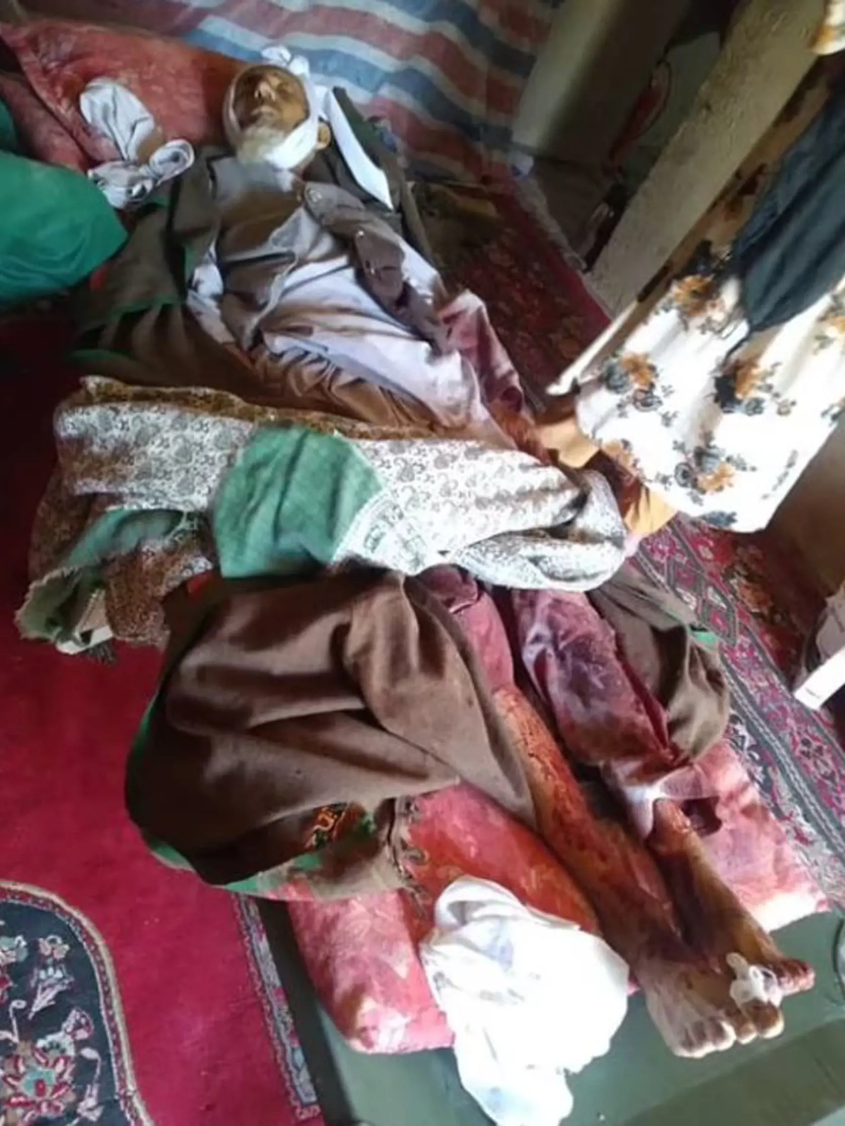 Ďalší obrázok, ktorý zverejnil Andarabi, zobrazuje staršieho muža, ktorého mučil Taliban.