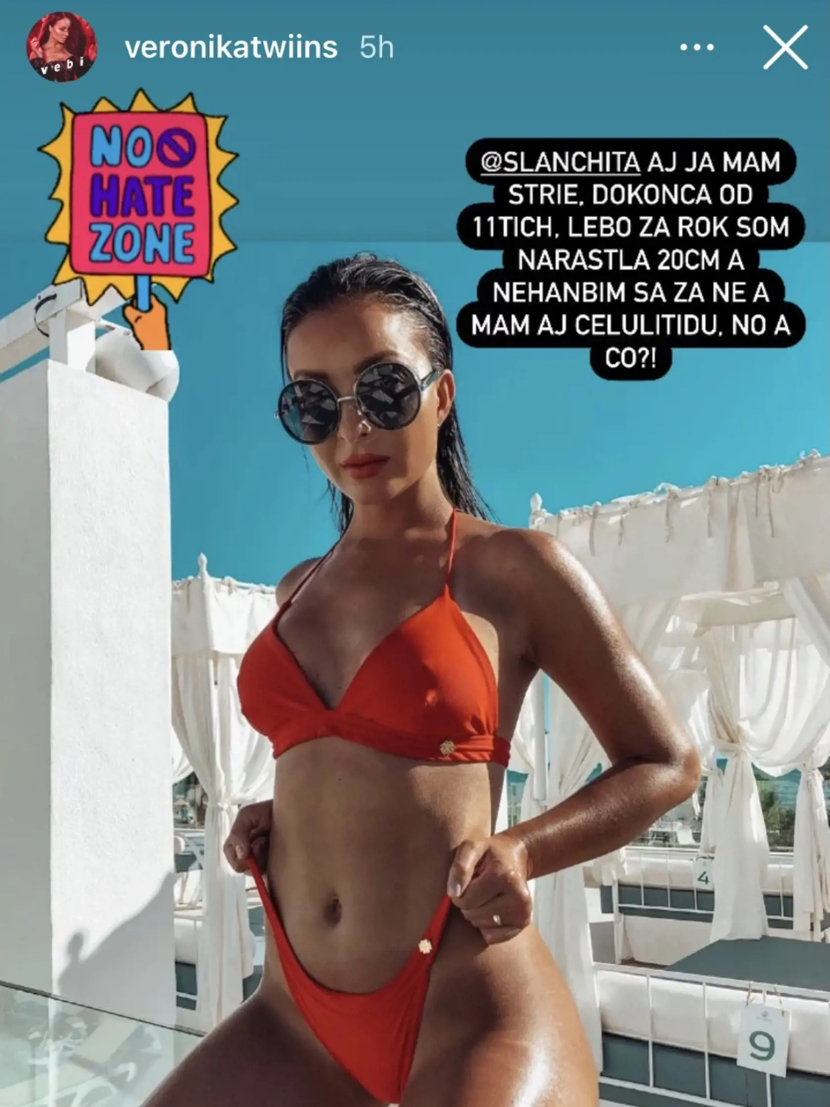 Veronika Nízlová sa tiež zapojila do debaty a podporila ženy s celulitídou a striami.