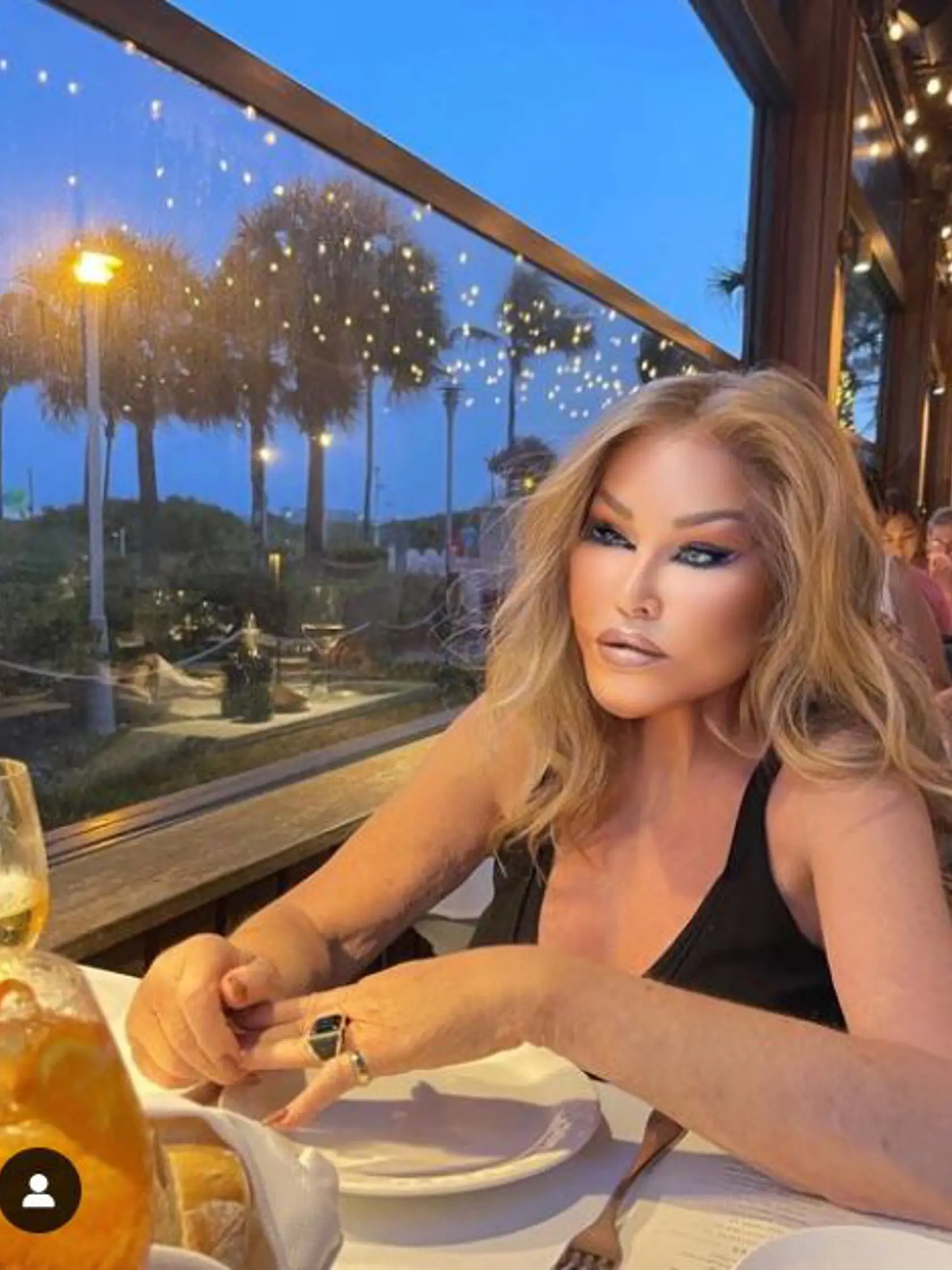 Aktuálne si však 81-ročná Jocelyn Wildenstein našla spôsob, ako byť znova peknou a atraktívnou. Podobne ako speváčka Madonna podľahla čaru fotografických filtrov, o ktorých kúzelnej moci už nikto nepochybuje. Mačacia žena totiž zverejnila niekoľko svojich nových a upravených fotografií, na ktorých vyzerá omnoho lepšie, ako v realite.
