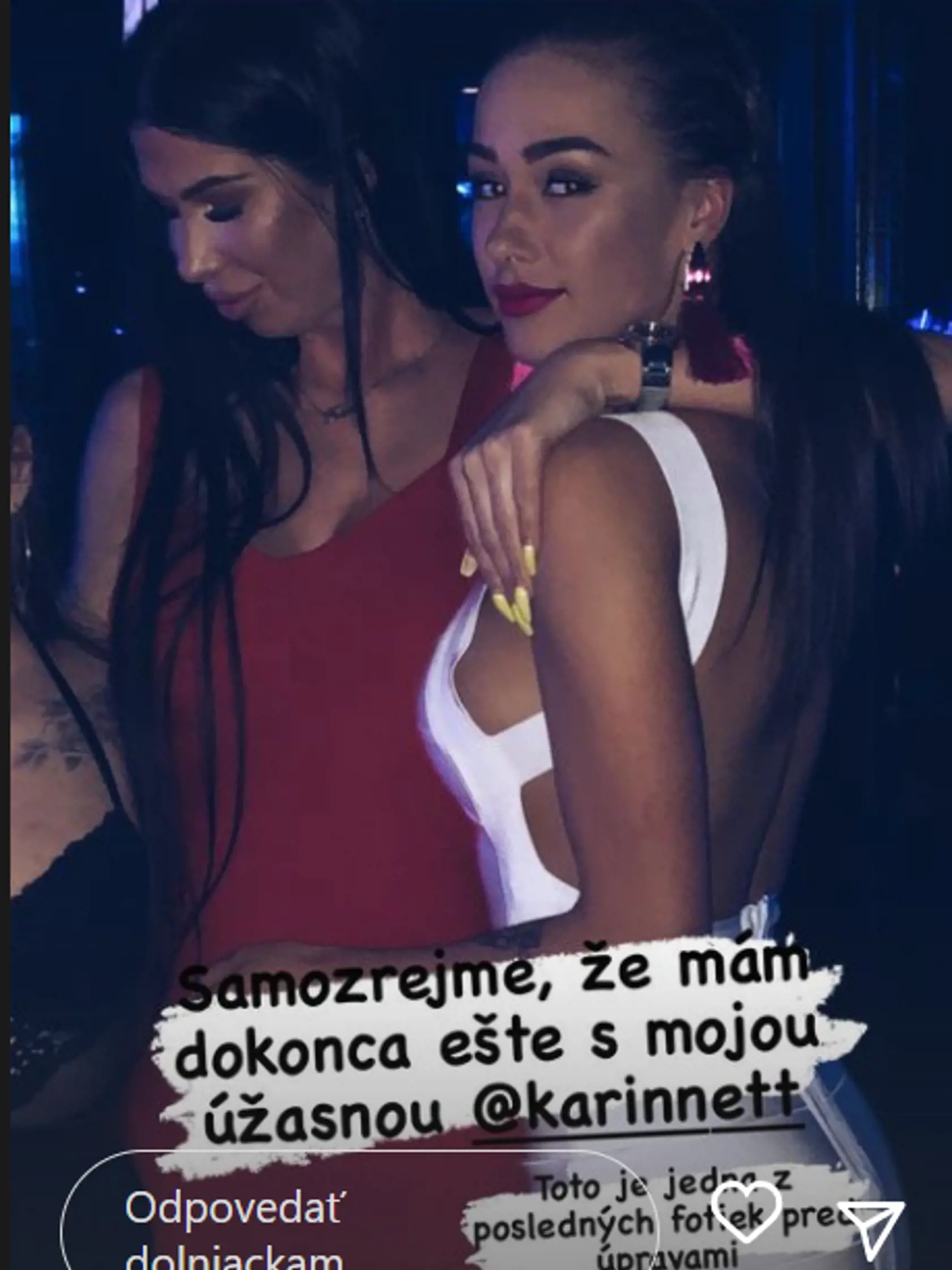 "Toto je jedna z posledných fotiek pred úpravami,“ napísala Marcela k záberu z párty, na ktorom je s kamarátkou Karin. Tá kedysi súťažila v reality šou Farma.