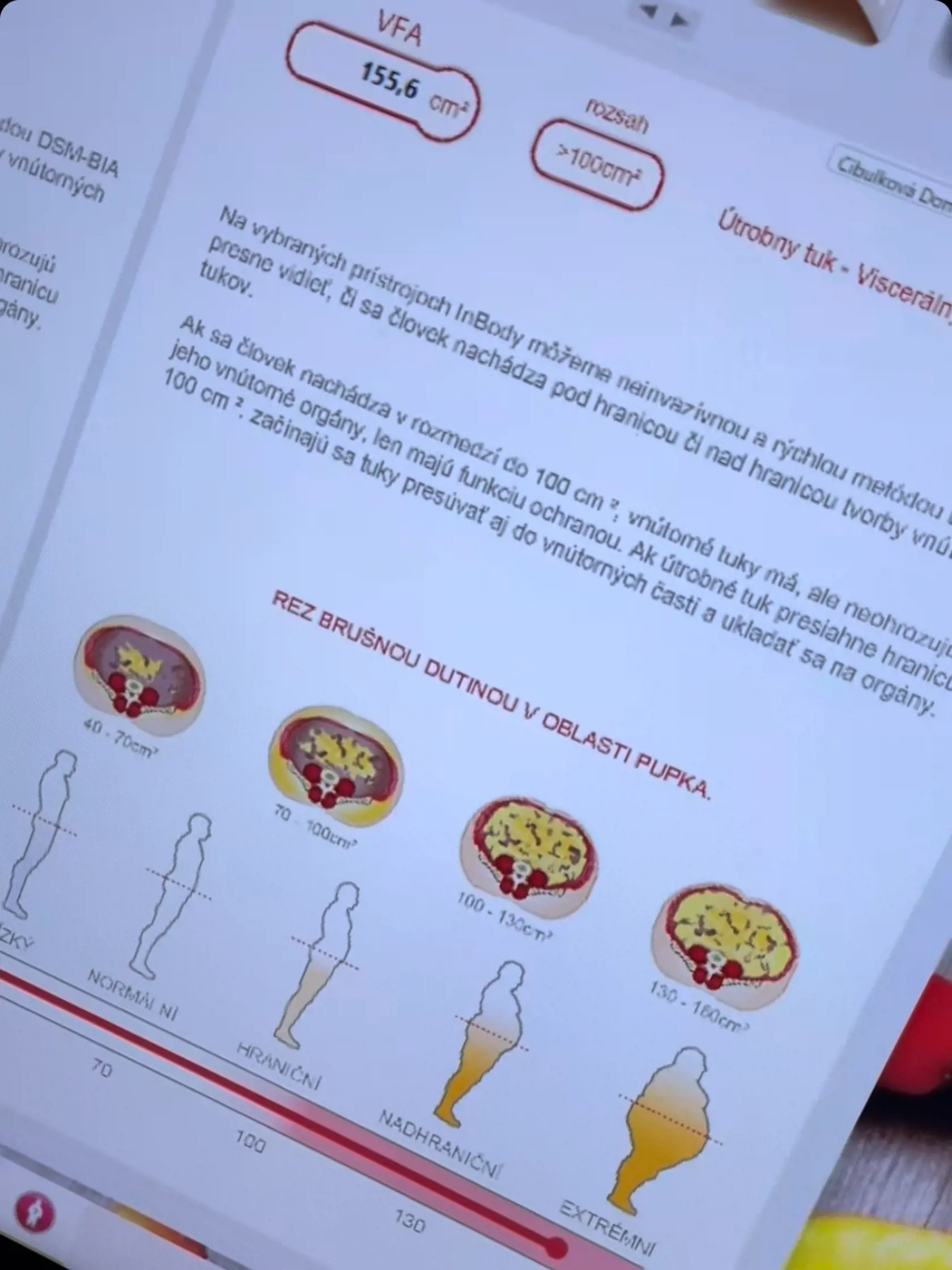 „Kamoši, mám pre vás novinky. Dnes som prvýkrát prekonala hranicu -20 kilogramov! Strašne sa teším,“ napísala Dominika Cibulková na svojom instagramovom účte.