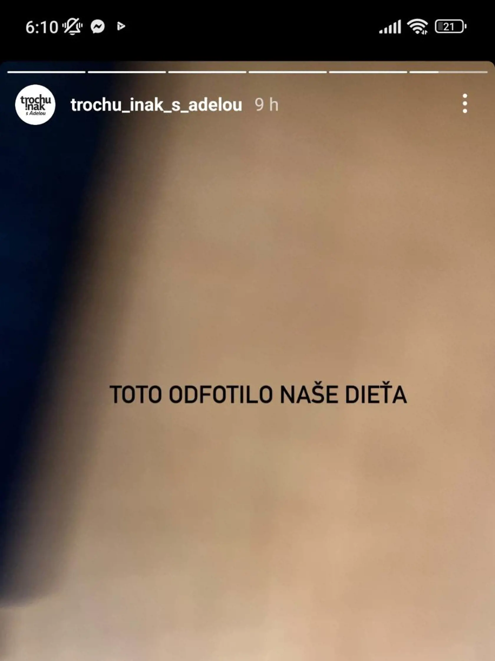 Adela sa podelila o prvý fotografický pokus ich dieťaťa.
