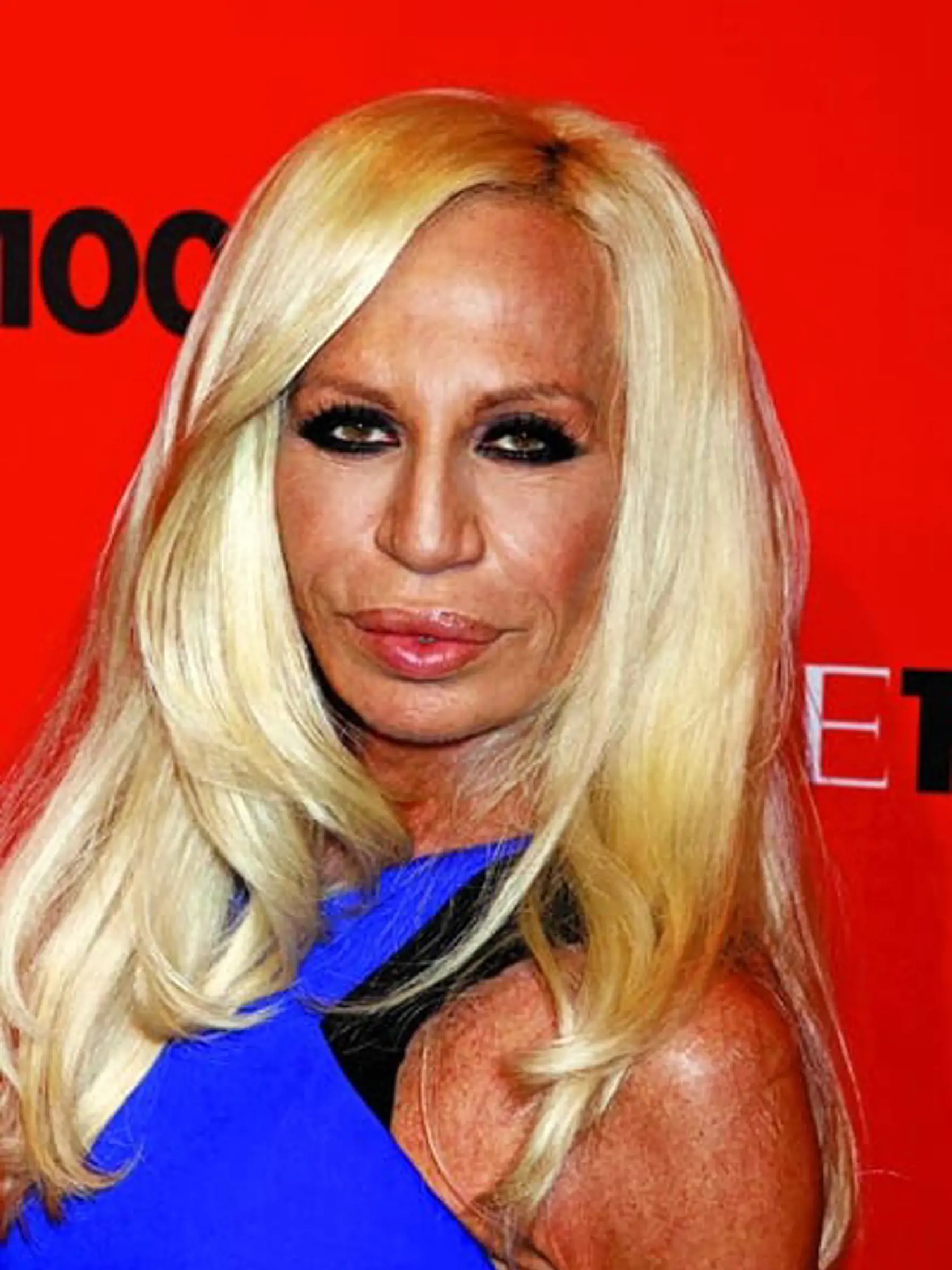 Donatella Versace môže slúžiť ako odstrašujúci príklad hneď v niekoľkých prípadoch.