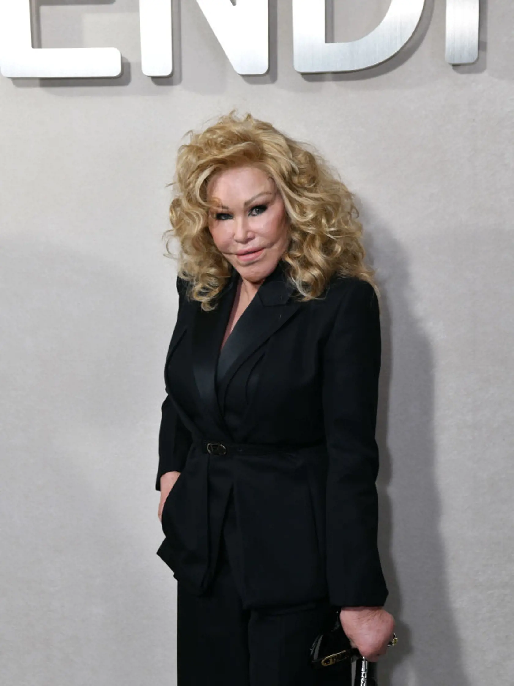 Jocelyn Wildenstein sa preslávila ako mačacia žena. Plastiky, ale vraj nemá, tak čo potom?