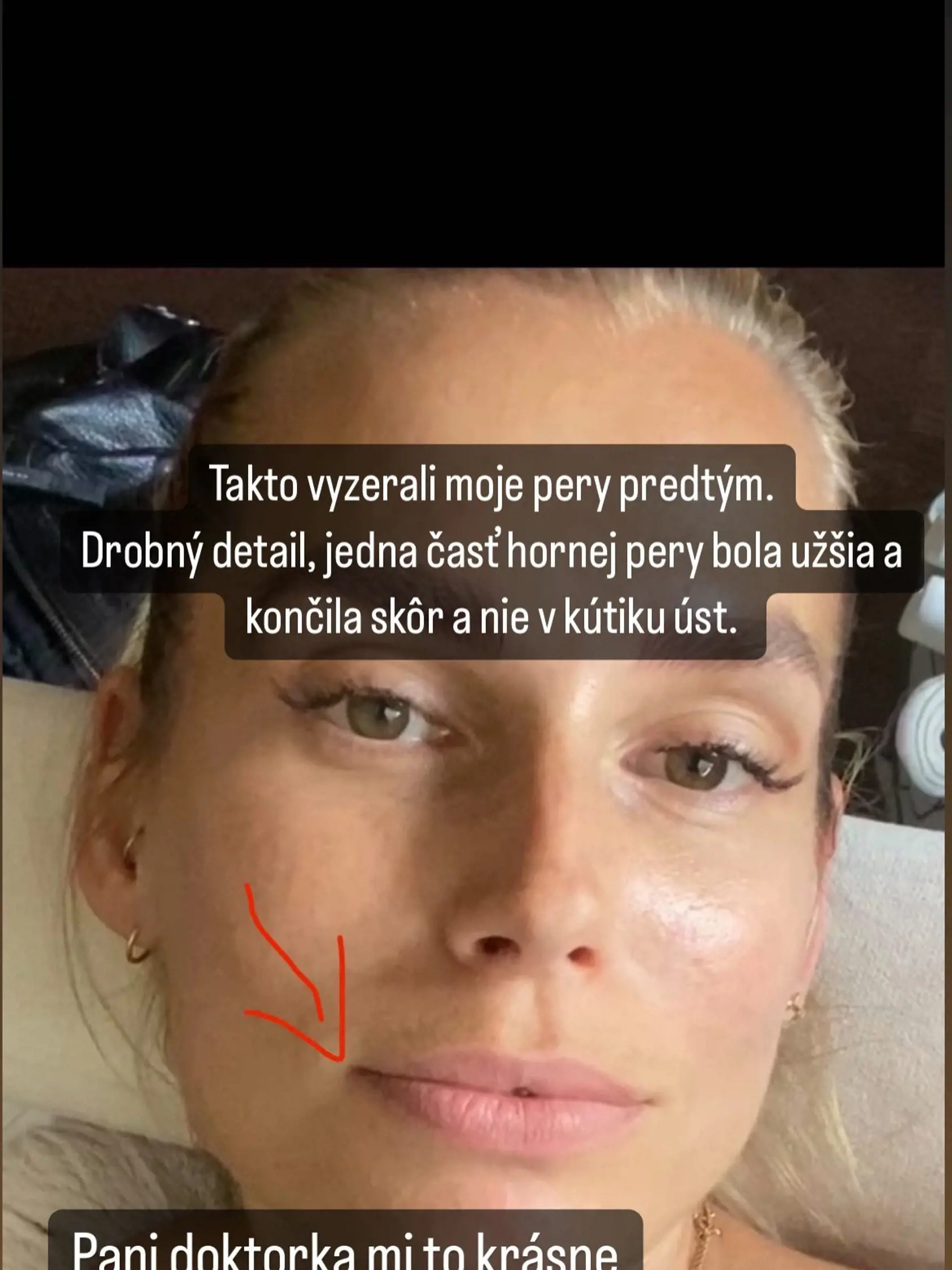 Diana prekvapila fanúšikov priznaním. Nikto si nevšimol, že si nechala upraviť pery.