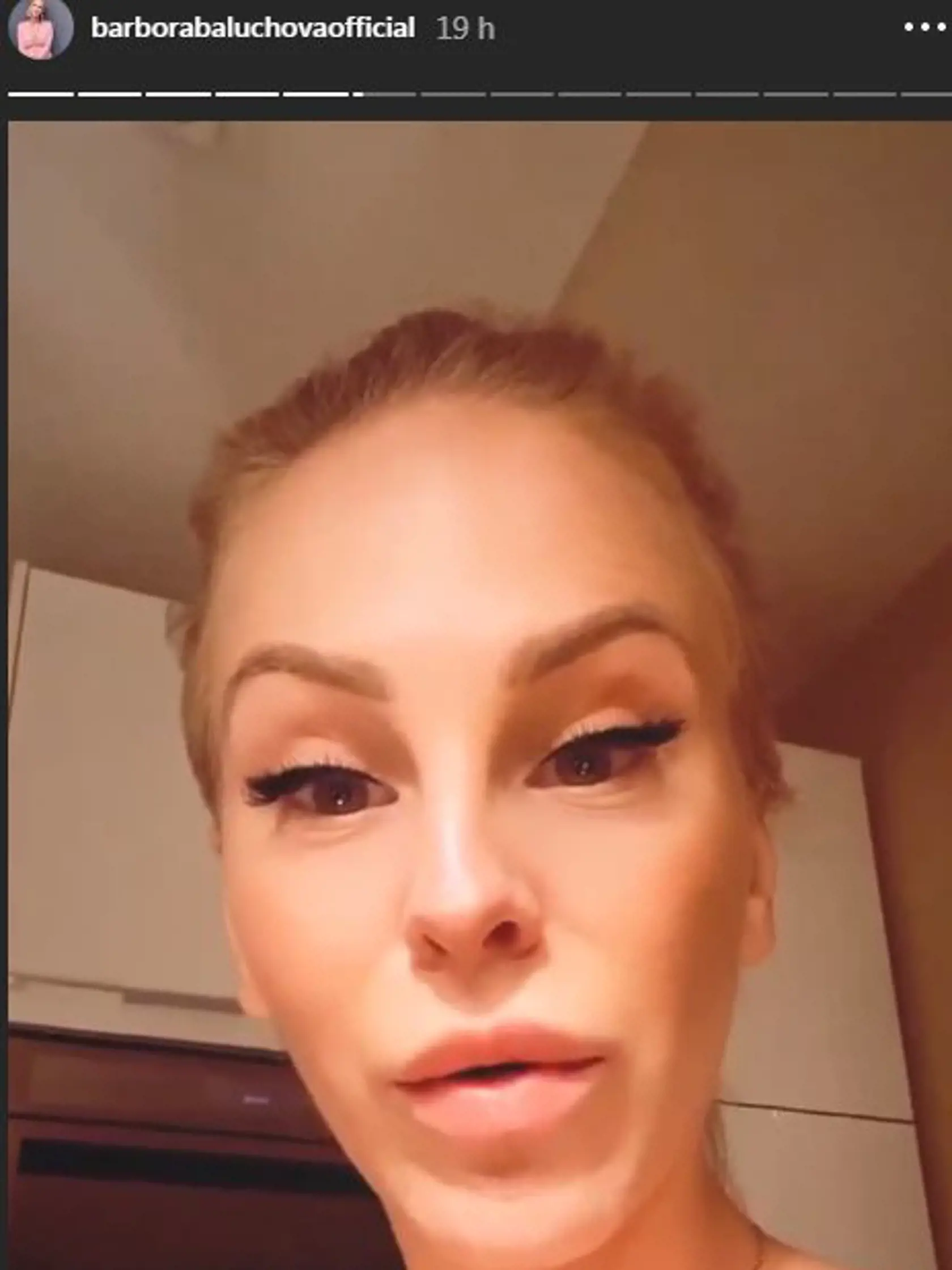 Barbora Balúchová opäť predviedla, akoby podstúpila nejaké vylepšenie. Jej "natiahnuté" oči sa nedajú prehliadnuť.