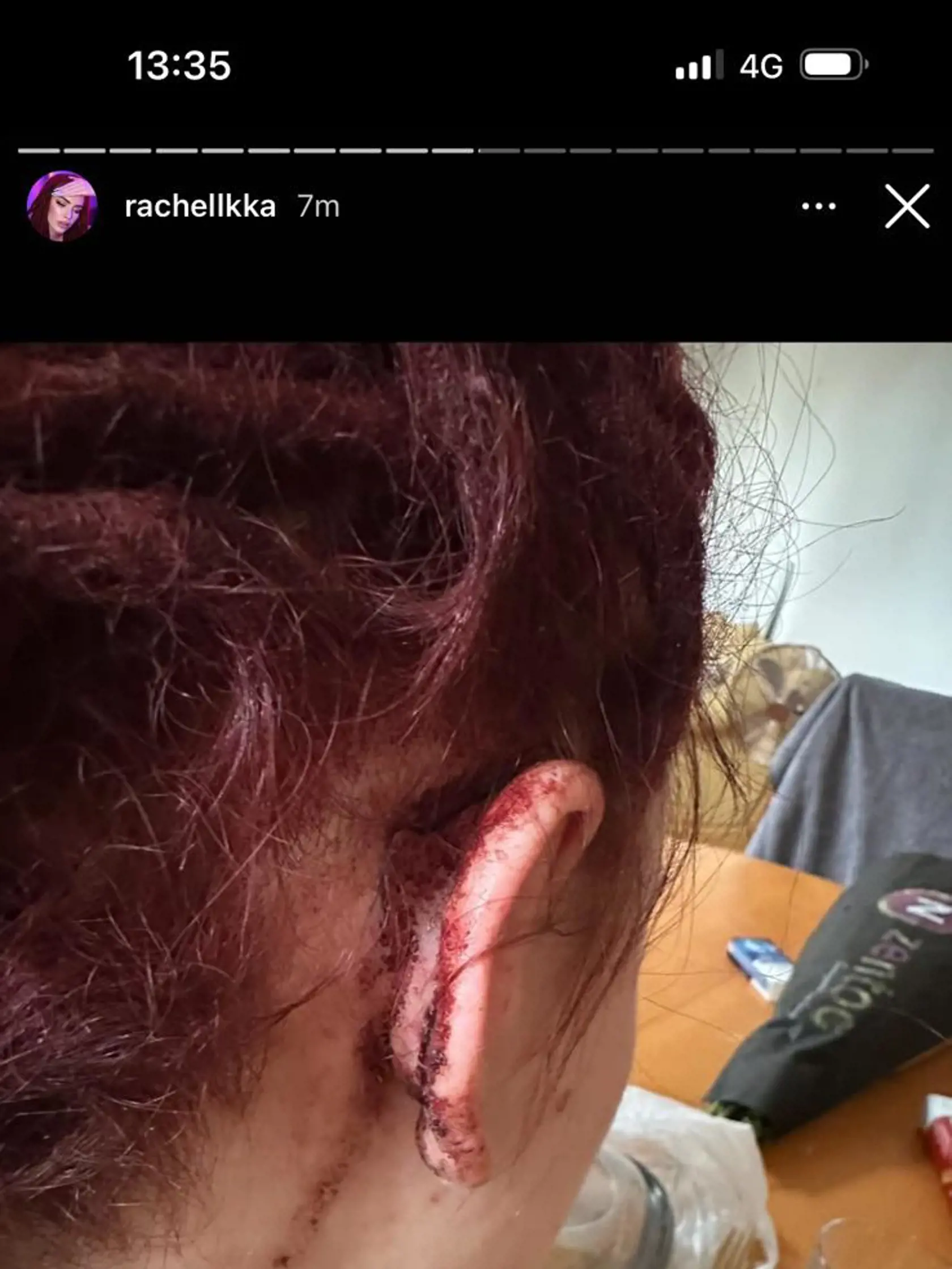 Rachel po bitke