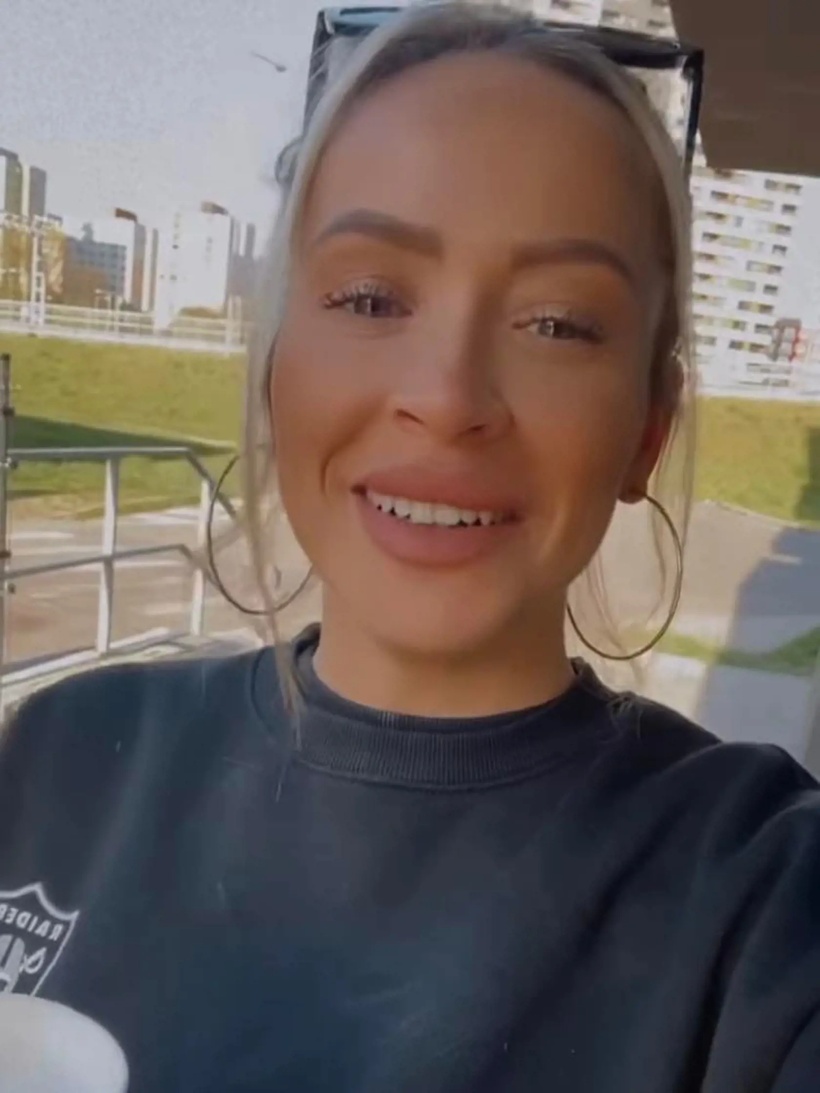Dominika Mirgová konečne prezradila, čo všetko si dáva na sebe vylepšovať.