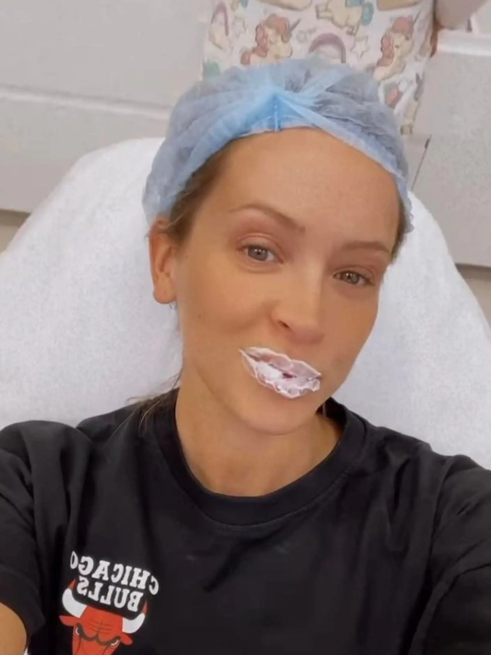 Dominika Mirgová konečne prezradila, čo všetko si dáva na sebe vylepšovať - pery, dáva si botox + hydratáciu pleti. A dokonca si dala pozdvihnúť oko.