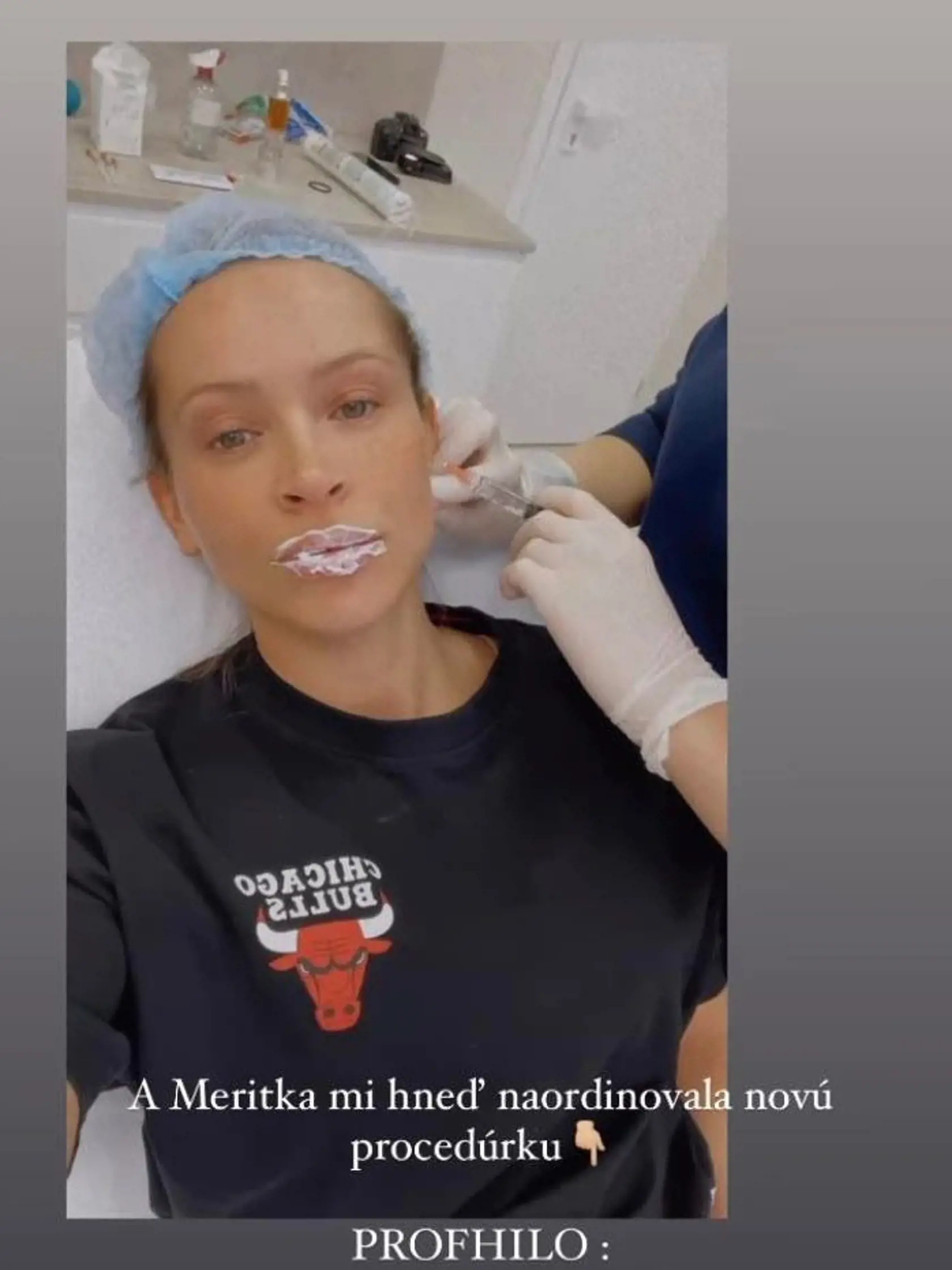 Dominika Mirgová konečne prezradila, čo všetko si dáva na sebe vylepšovať.