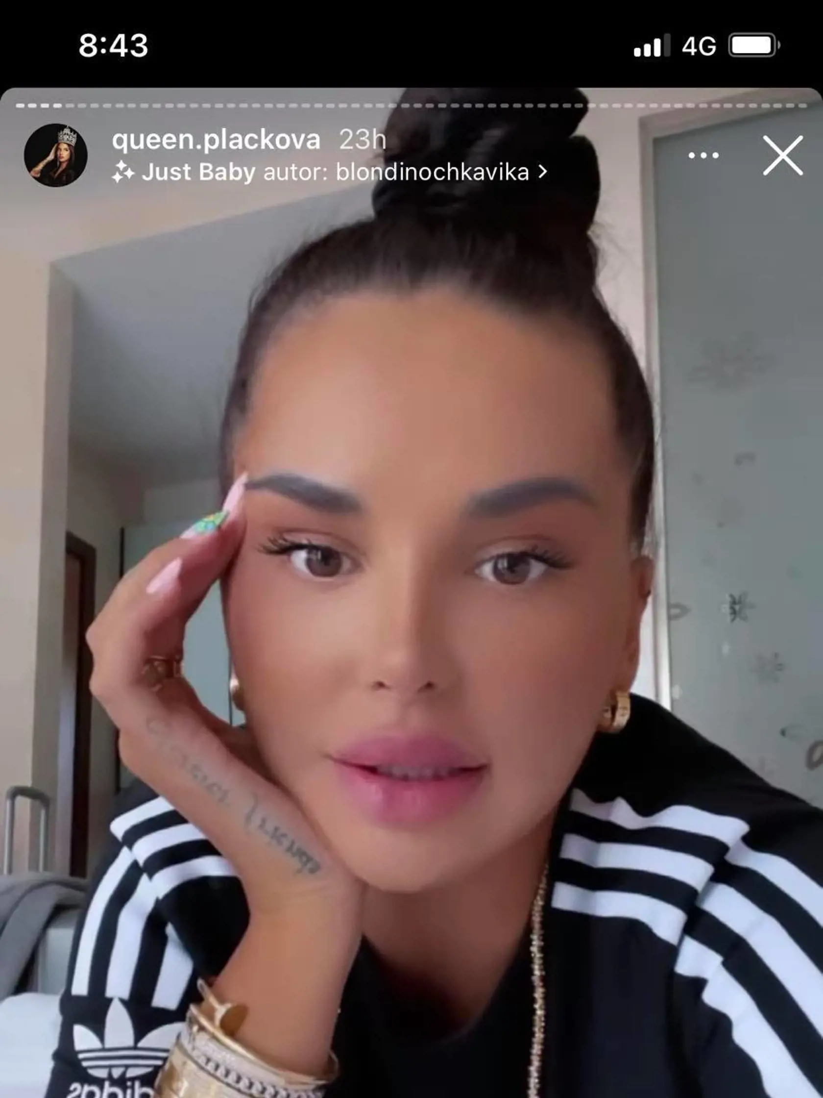 Na klinike v Maďarsku je už aj speváčka Tina a Zuzana Plačková.