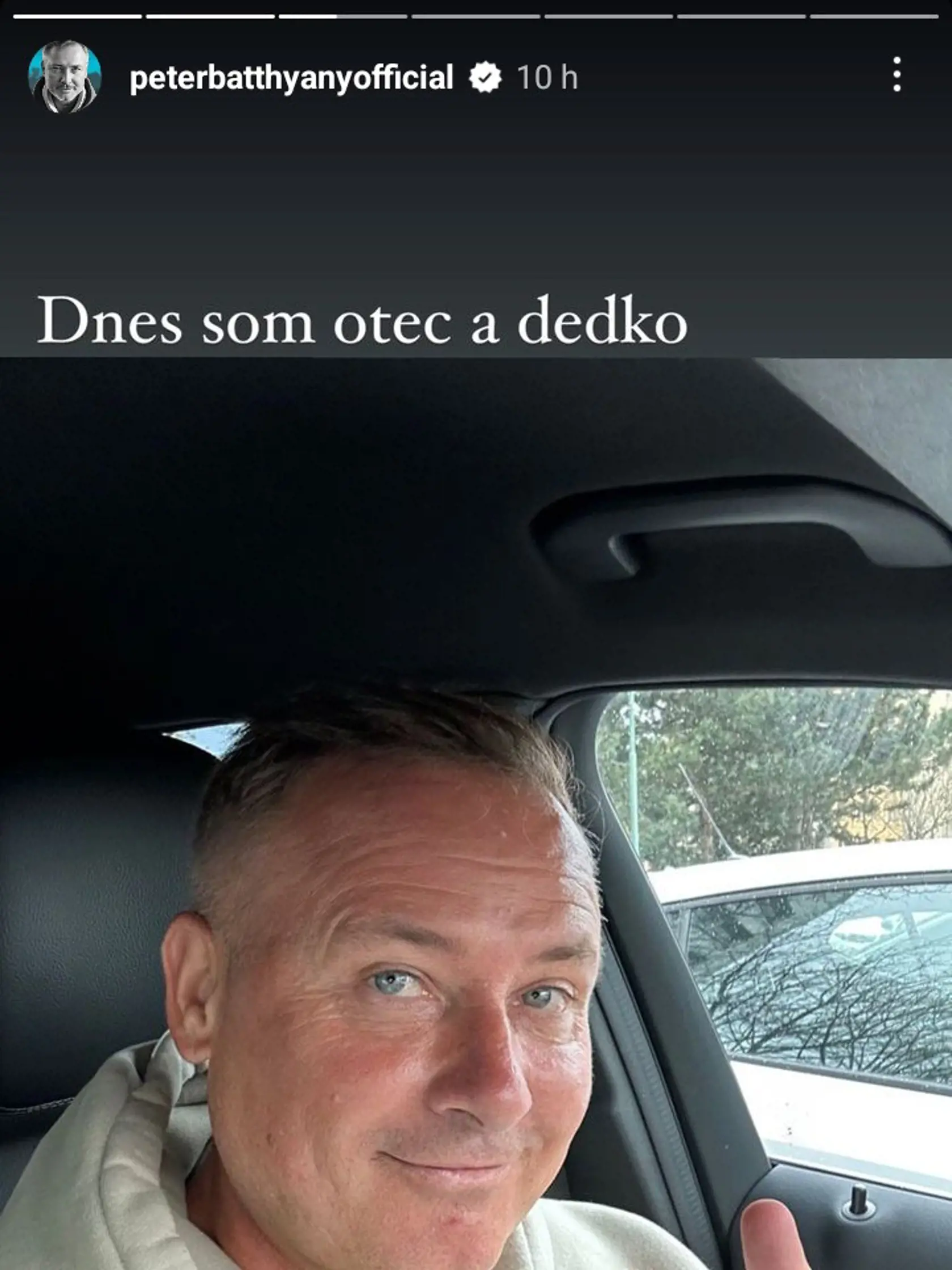 Peter Batthyany akoby o 10 rokov omladol.