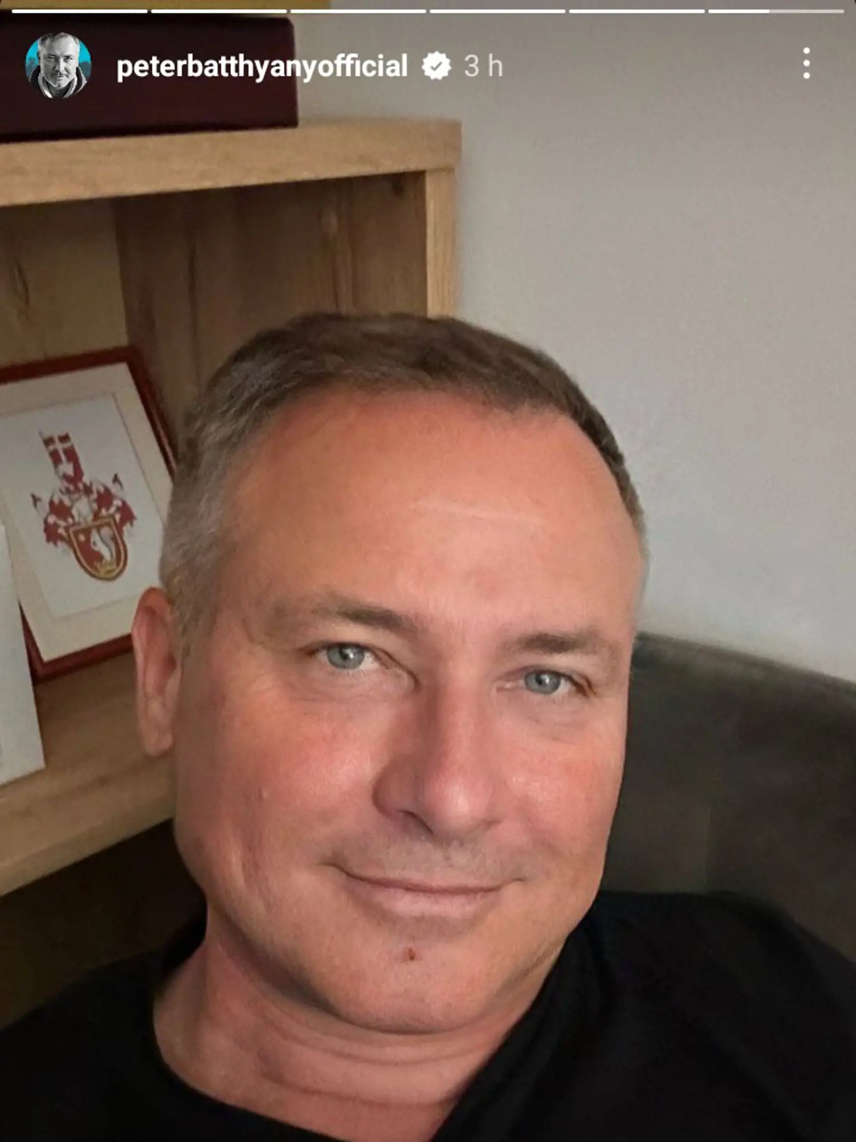 Peter Batthyany vyzerá skvelo.