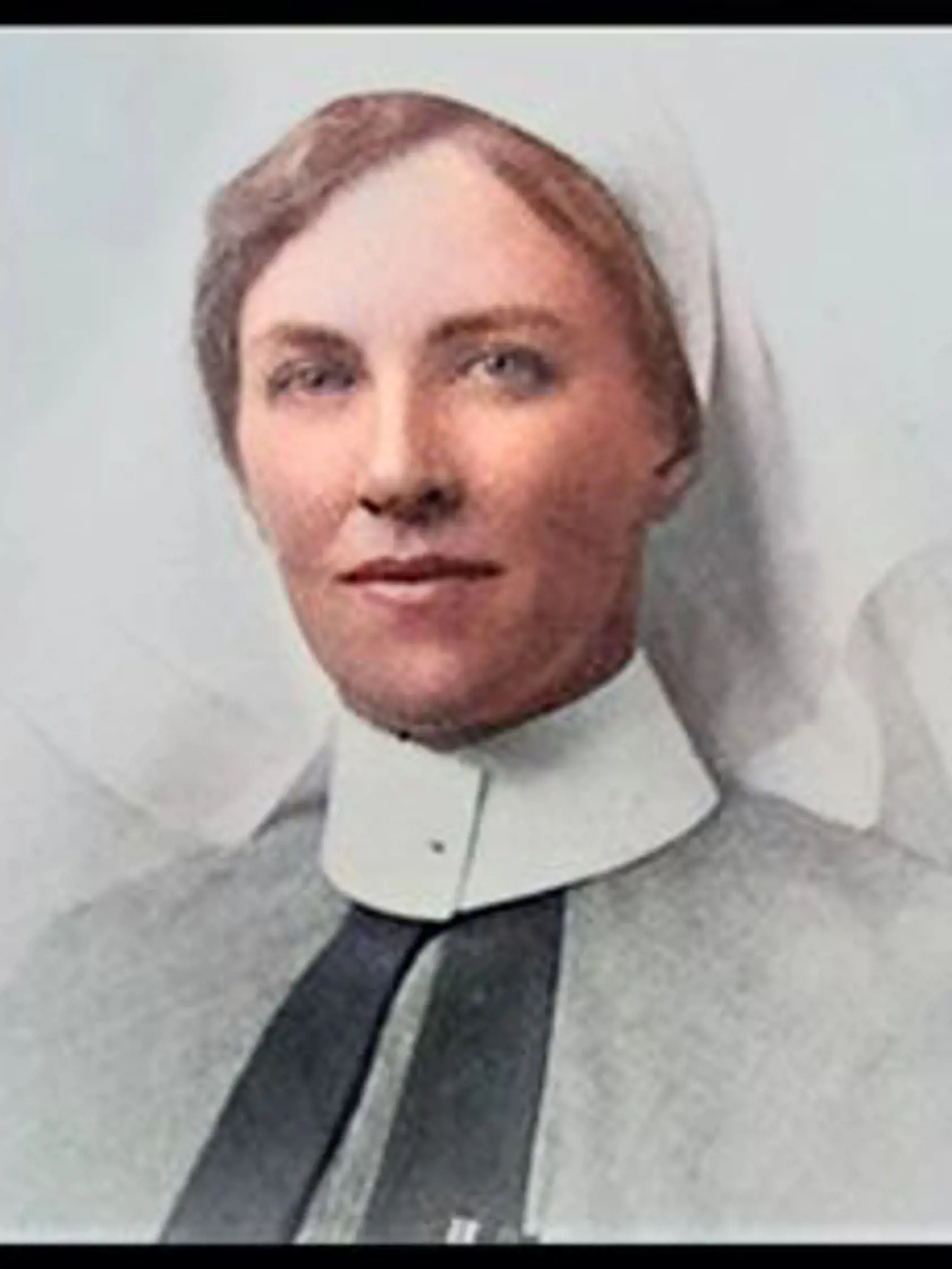 Maryin manžel Thomas náhle zomrel v roku 1914 a zanechal Mary so štyrmi deťmi. Krátko po strate manžela sa u nej začali prejavovať príznaky akromegálie, poruchy charakterizovanej nadprodukciou rastových hormónov v hypofýze. Akromegália je jedným zo zriedkavých stavov hypofýzy a dnes sa dá liečiť, ak sa zistí dostatočne skoro. Avšak v rámci obmedzení medicíny na začiatku 20. storočia nemala Mary žiadnu možnosť liečby. Jej črty tváre a celkový výzor sa tak zmenili na nepoznanie.