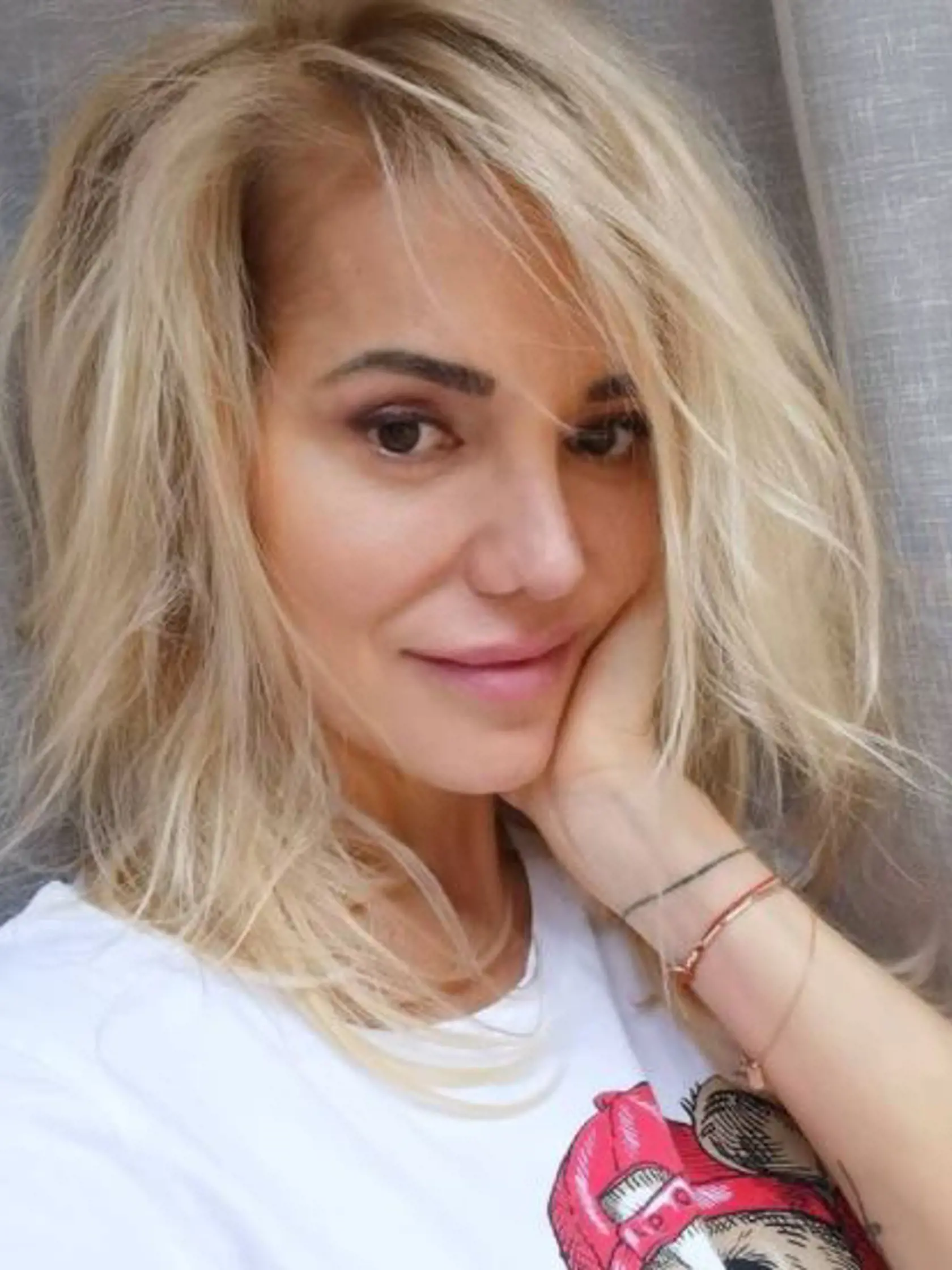 Takto vyzerá Dara po štvrtej úprave nosa. Najnovšie ho ukázala celkom zblízka.