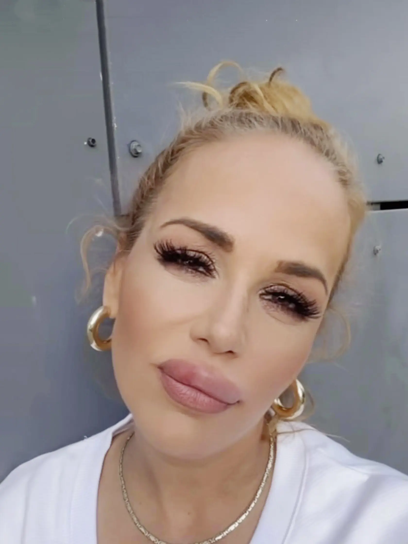 Opuchnutá Karin Hajdu. Aj herečka a moderátorka toto leto zažila nepríjemný bodavý útok a napuchla jej horná pera.