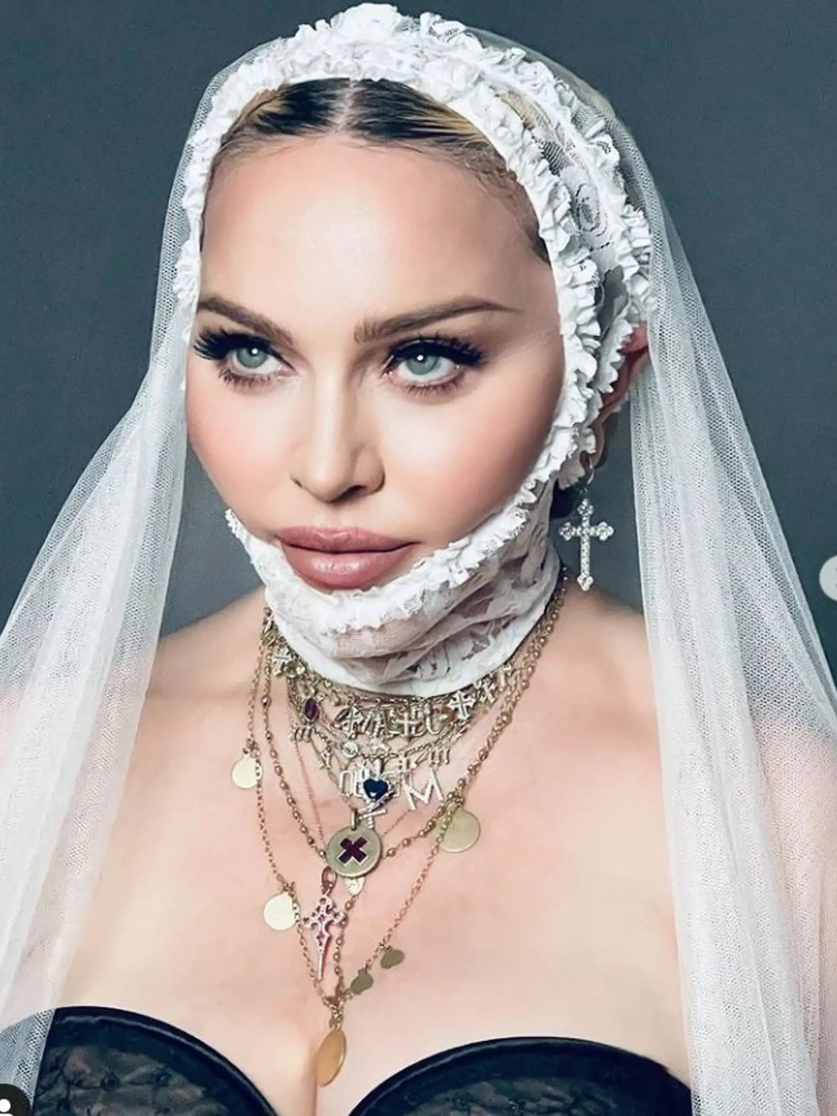 Madonna vyzerá na fotografiách úplne inak, ako v skutočnosti.