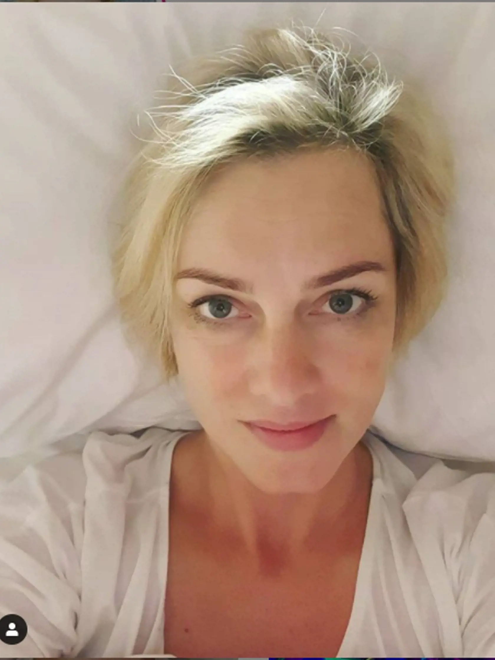 Monika Hilmerová má za sebou operáciu.