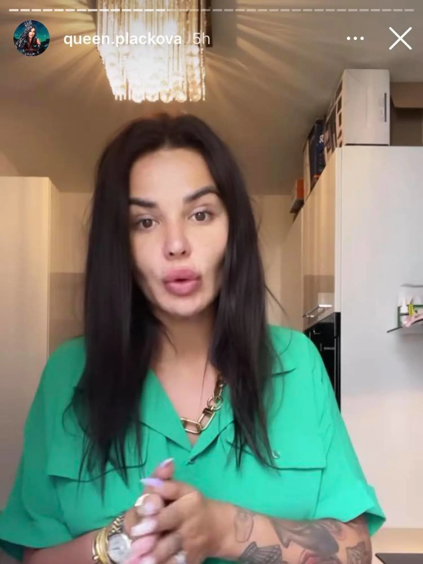 Jún 2021: Zuzana Plačková prvýkrát ukázala tvár po plastike bez štipky mejkapu a skrášľovacích filtrov.