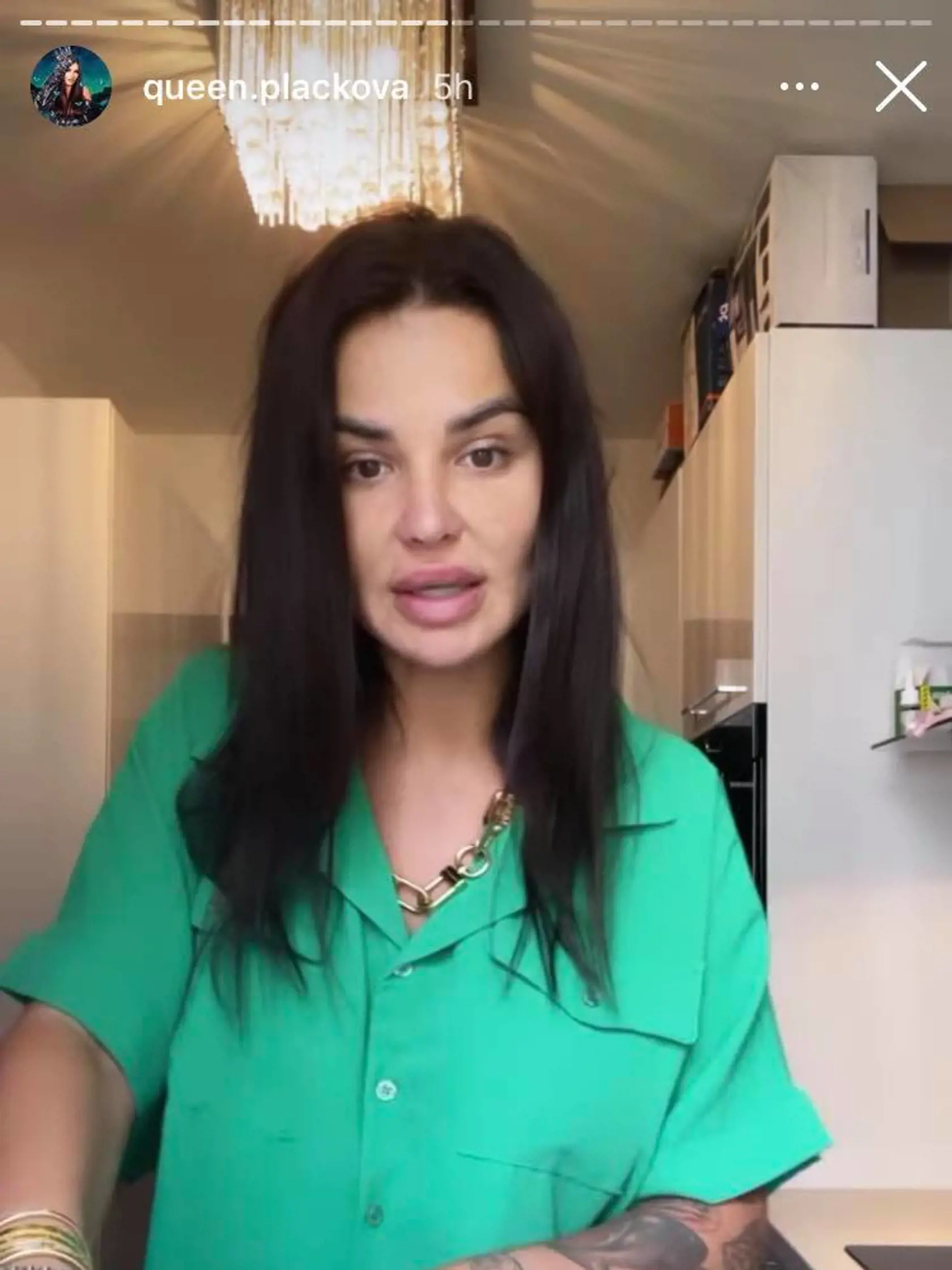 Jún 2021: Zuzana Plačková prvýkrát ukázala tvár po plastike bez štipky mejkapu a skrášľovacích filtrov.