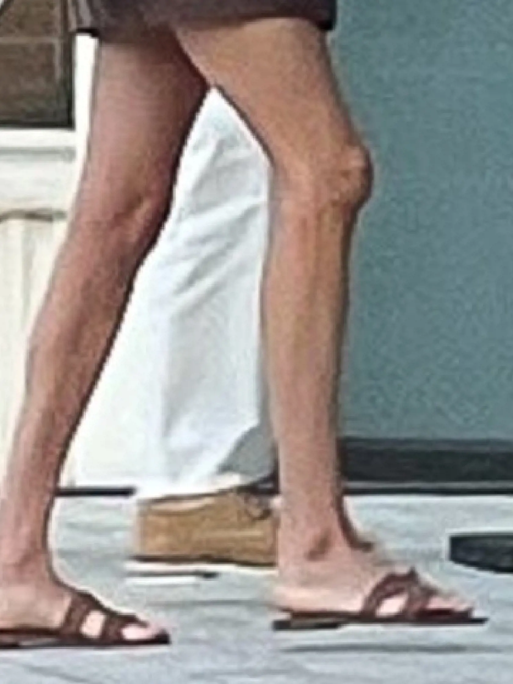 Manželka princa Harryho Meghan Markle má už nohy ako dve špáradlá.