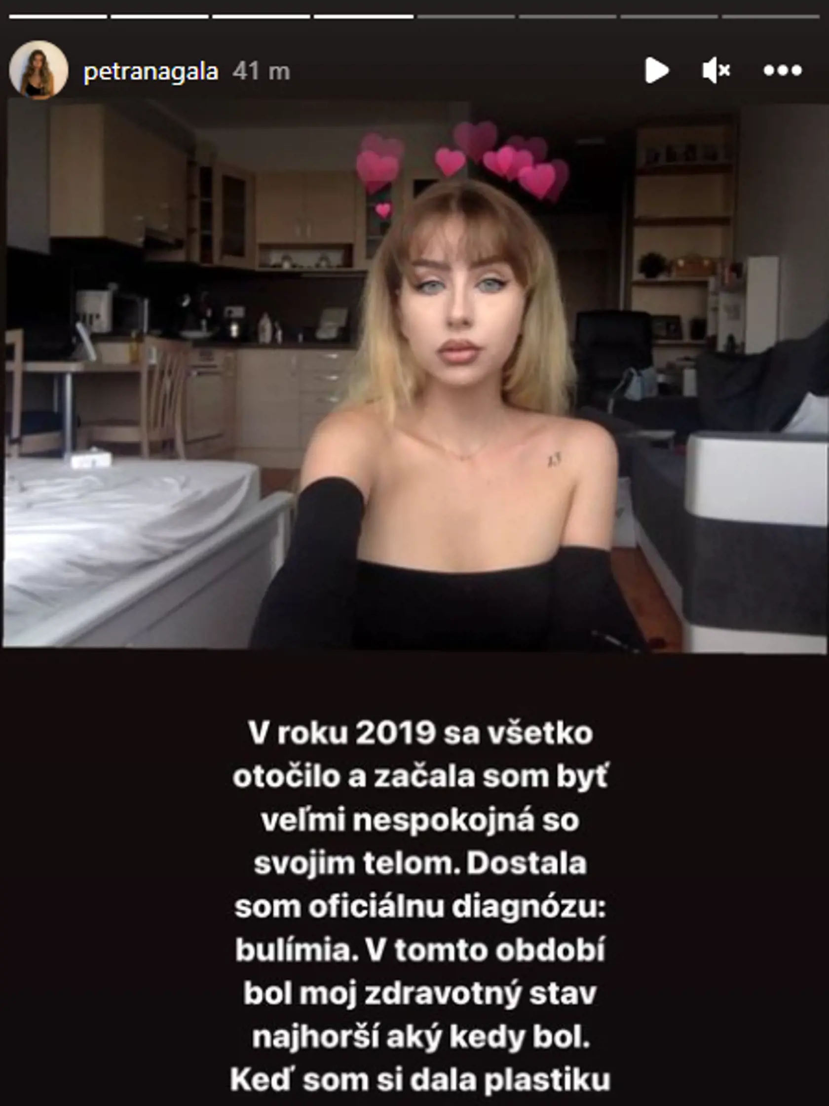 Petrana priznala, že pred plastikou bojovala s bulímiou a bolo to najťažšie obdobie v jej živote.