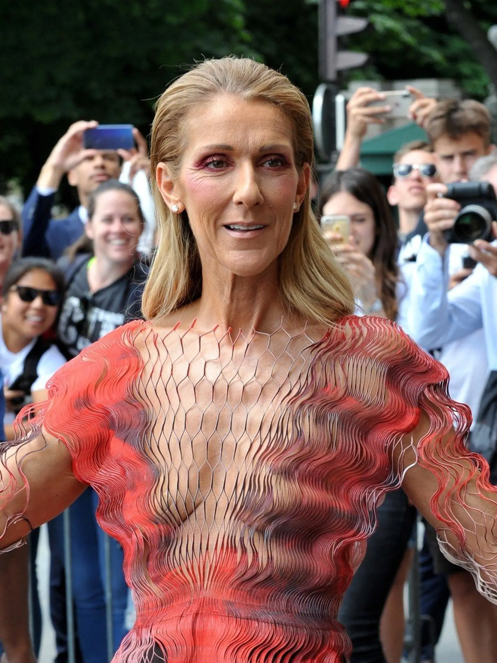 Speváčka Céline Dion sa už koncom minulého roka zverila svojím fanúšikom, že trpí syndrómom stuhnutého človeka (SPS), ktorý napáda aj jej hlasivky a mimiku tváre. Ochorenie žiaľ nie je liečiteľné, pomocou liekov a špeciálnych cvičení sa však dá spomaliť.