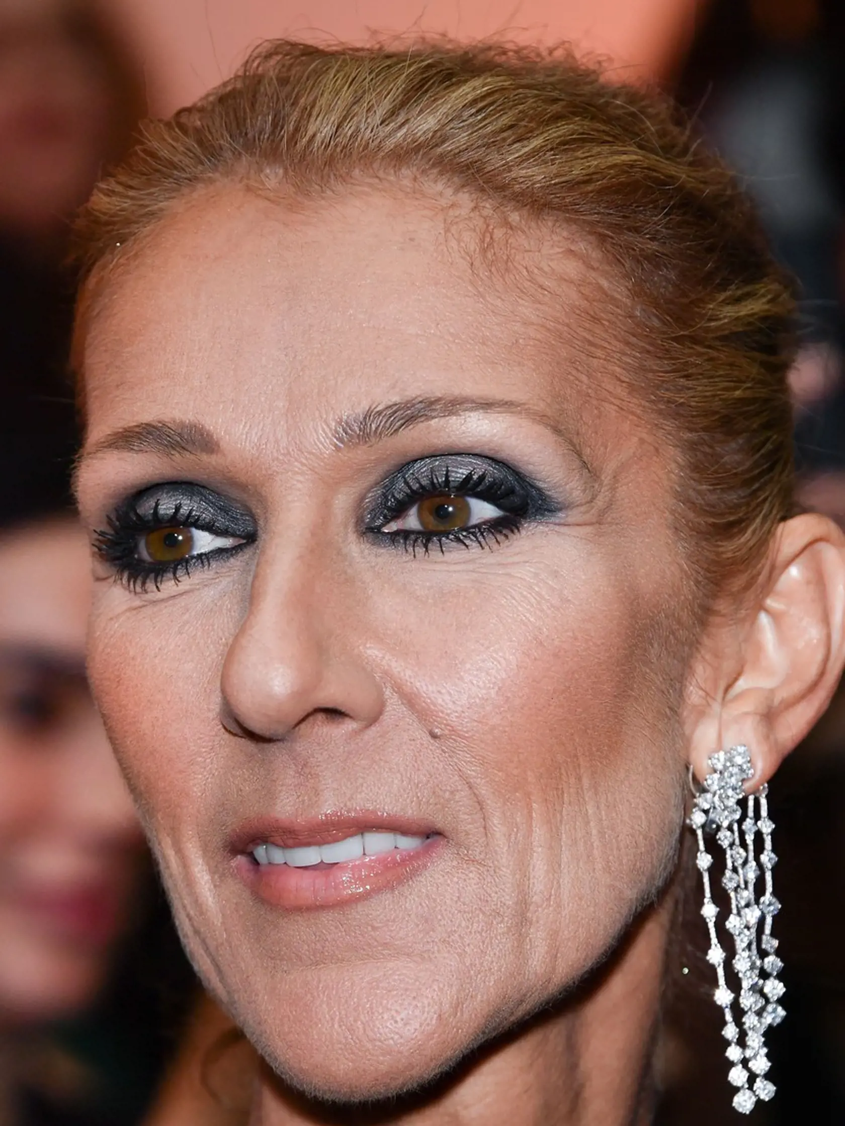 Speváčka Céline Dion sa už koncom minulého roka zverila svojím fanúšikom, že trpí syndrómom stuhnutého človeka (SPS), ktorý napáda aj jej hlasivky a mimiku tváre. Ochorenie žiaľ nie je liečiteľné, pomocou liekov a špeciálnych cvičení sa však dá spomaliť.