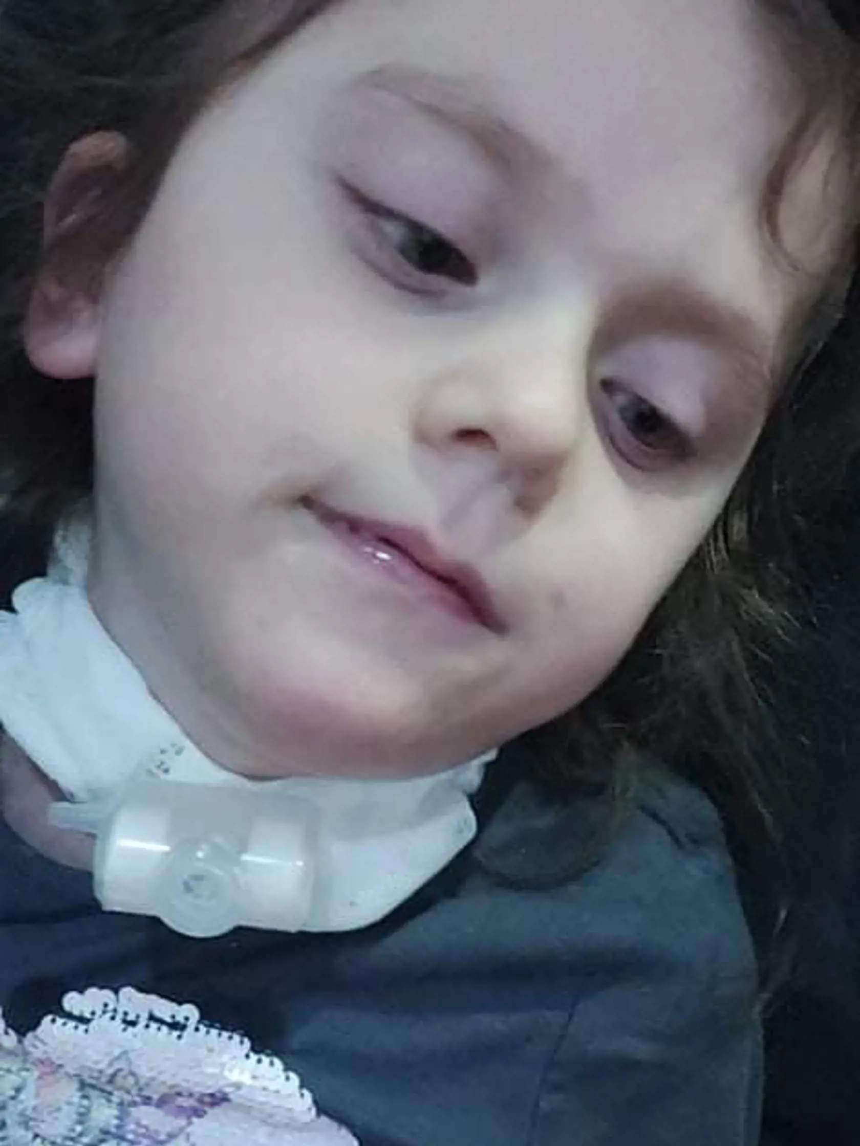Katka má Westov syndróm, čo je forma epilepsie. Mama Klára sa jej snaží pomôcť všetkými možnými spôsobmi