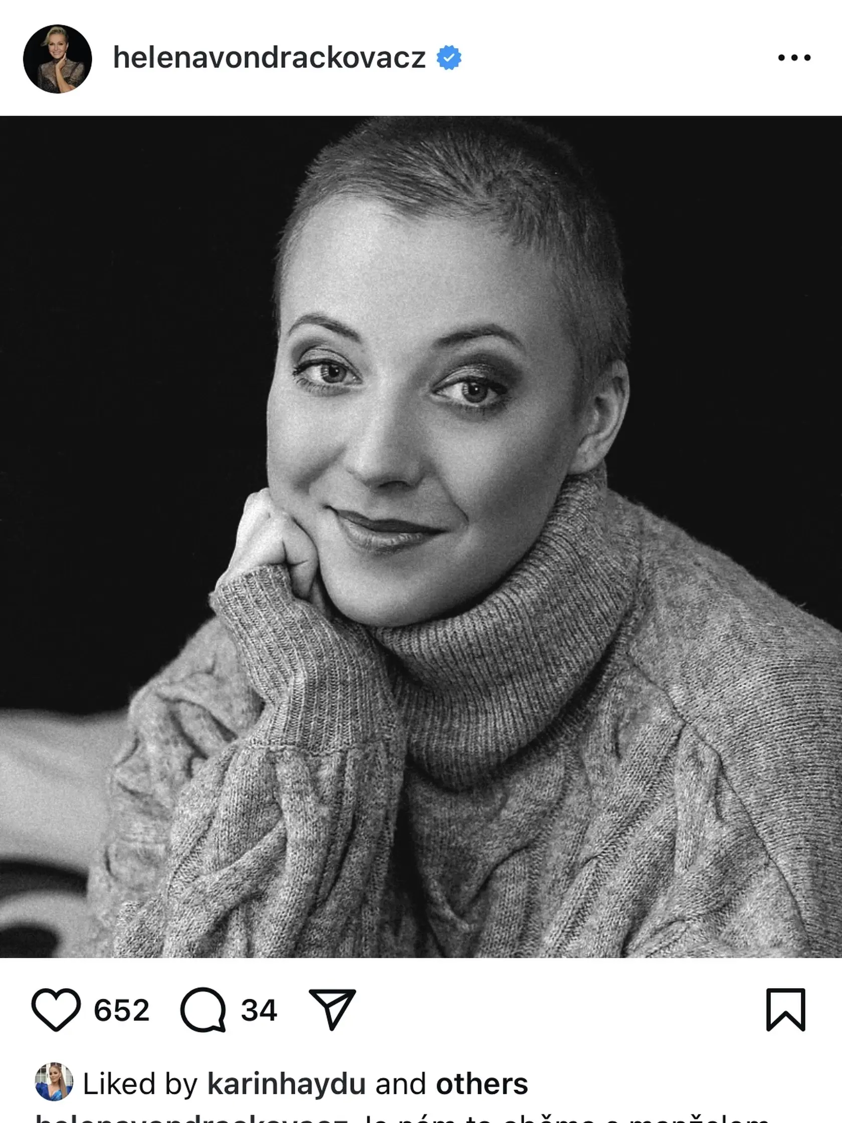 Smrť Aničky Slováčkovej (†29) zarmútila aj známe tváre. Odkaz do neba jej posiela aj Helena Vondráčková.