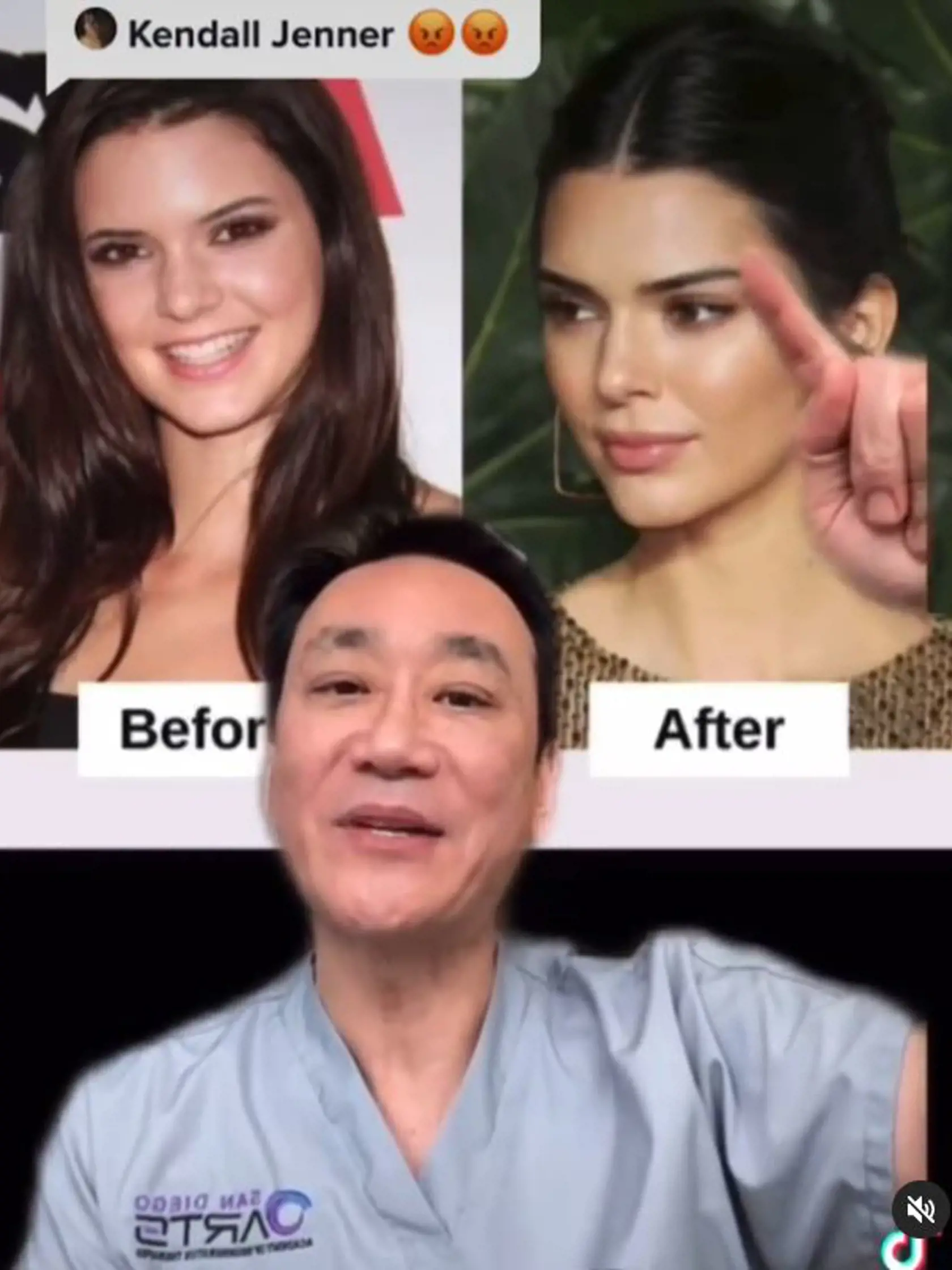 Kendall Jenner