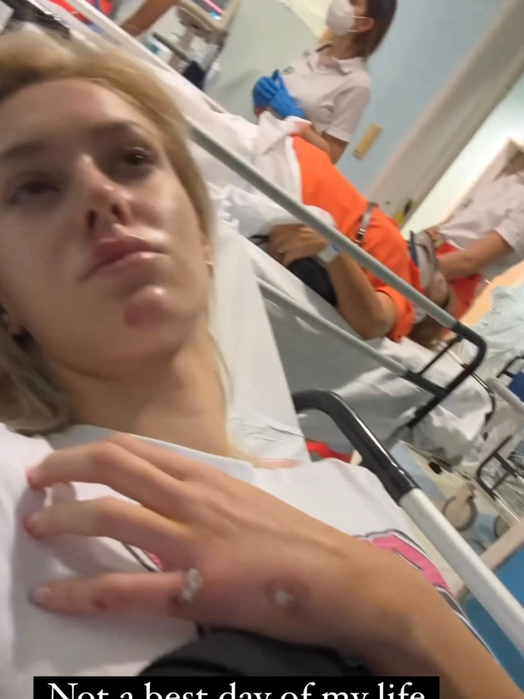 Veronika Rajek sa nedávno zranila na kolobežke.