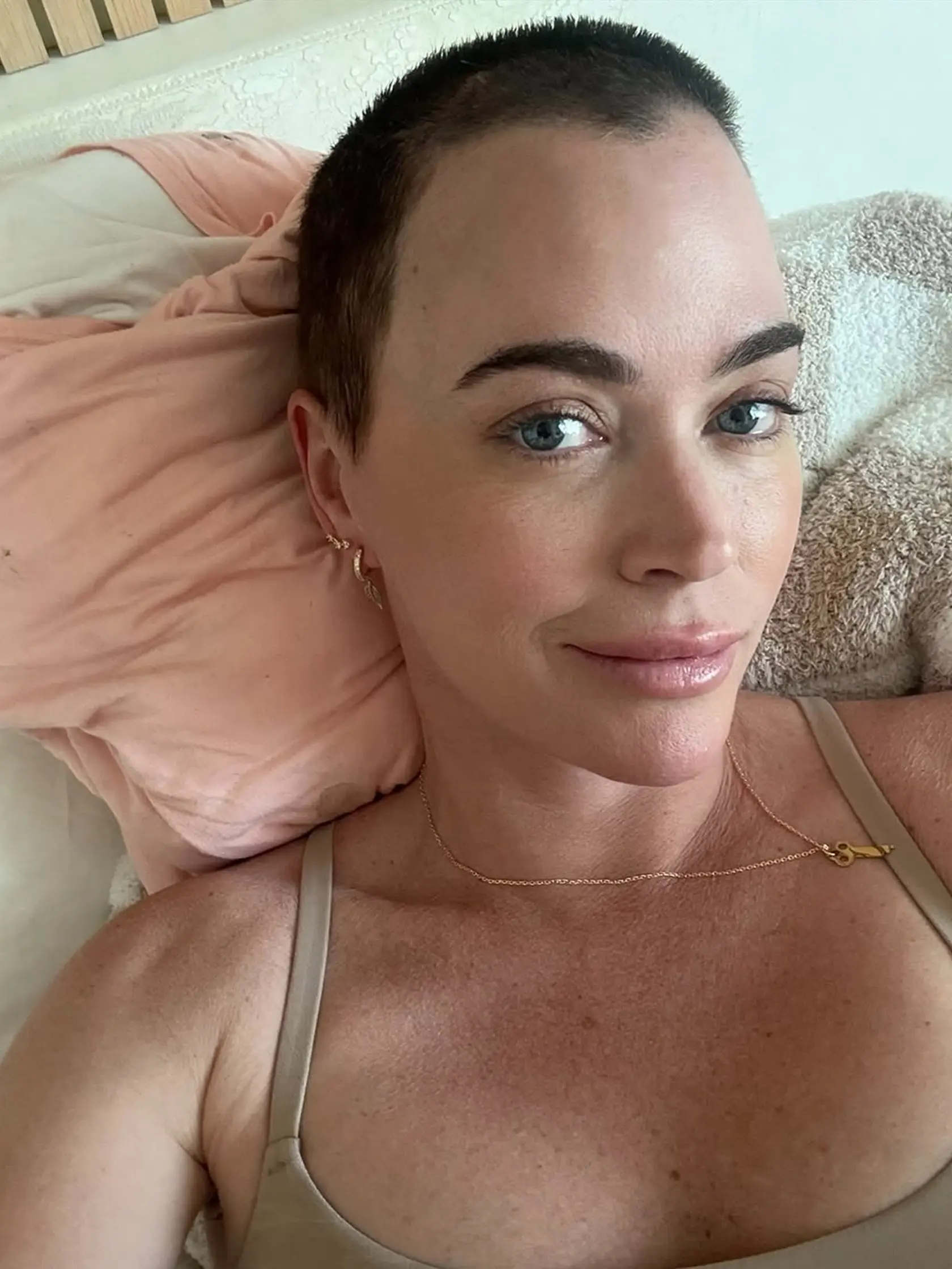 Teddi Mellencamp zdieľa šokujúce správy: Diagnostikovali jej štyri nové mozgové nádory, ktoré sú výsledkom metastázy melanómu.