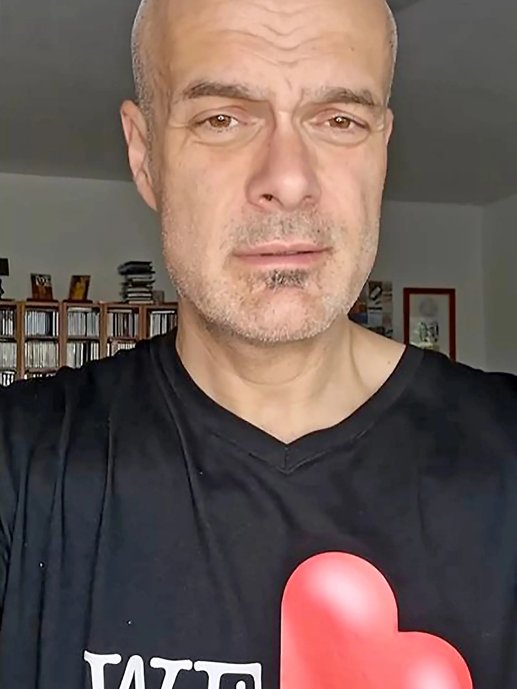MÁJ 2023 Vychudnutý. Slávik má na nových fotografiách, hore, prepadnuté líca a v tvári pôsobí extrémne štíhlo.