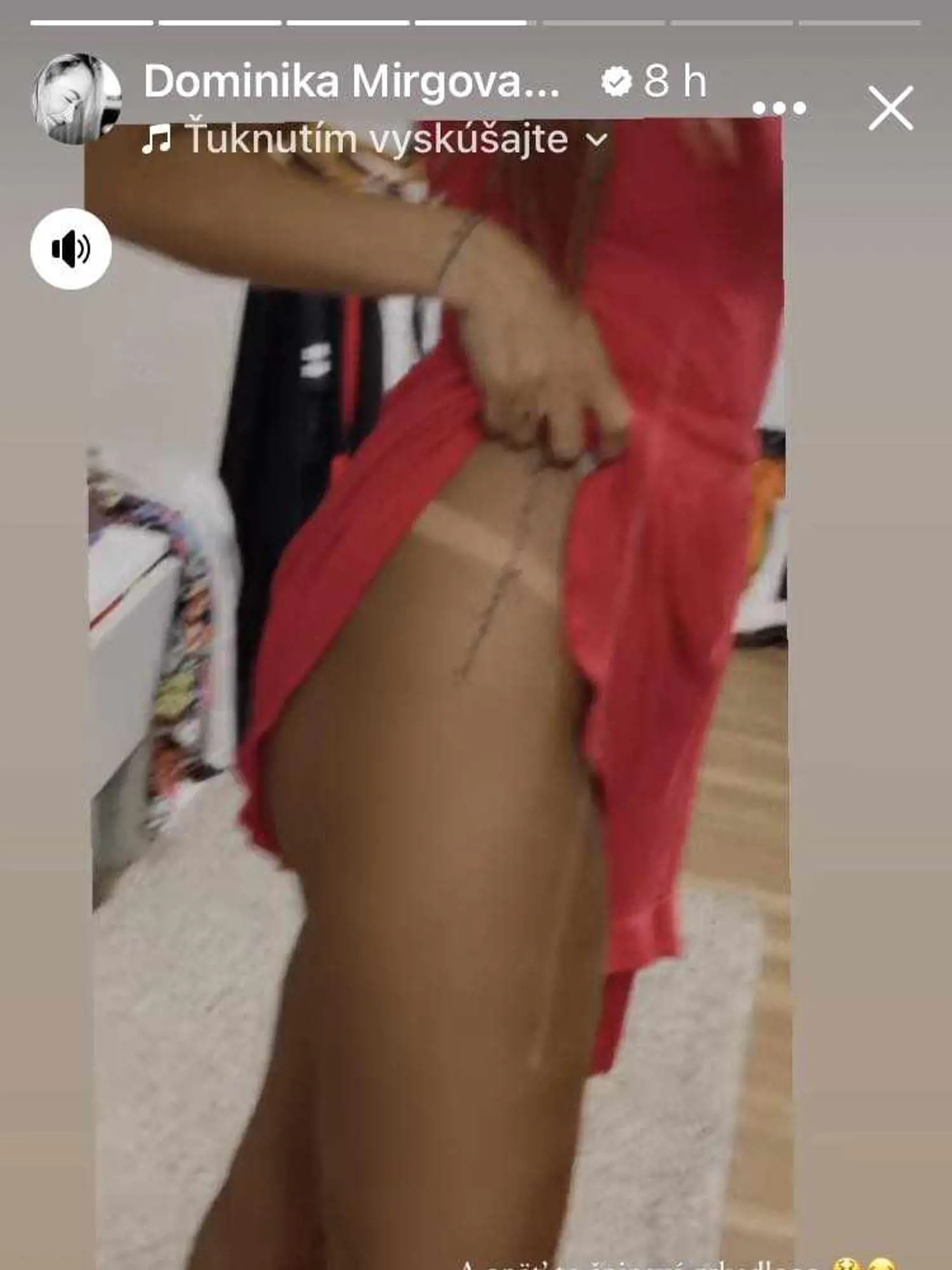 O radosť z opálenia sa podelila aj speváčka Dominika Mirgová.