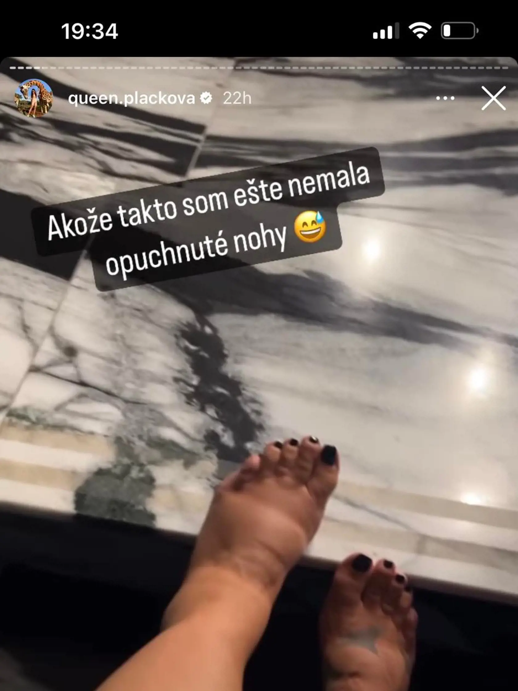 Zuzana Plačková čoskoro rodí a posledné dni sú pre ňu už poriadne náročné.