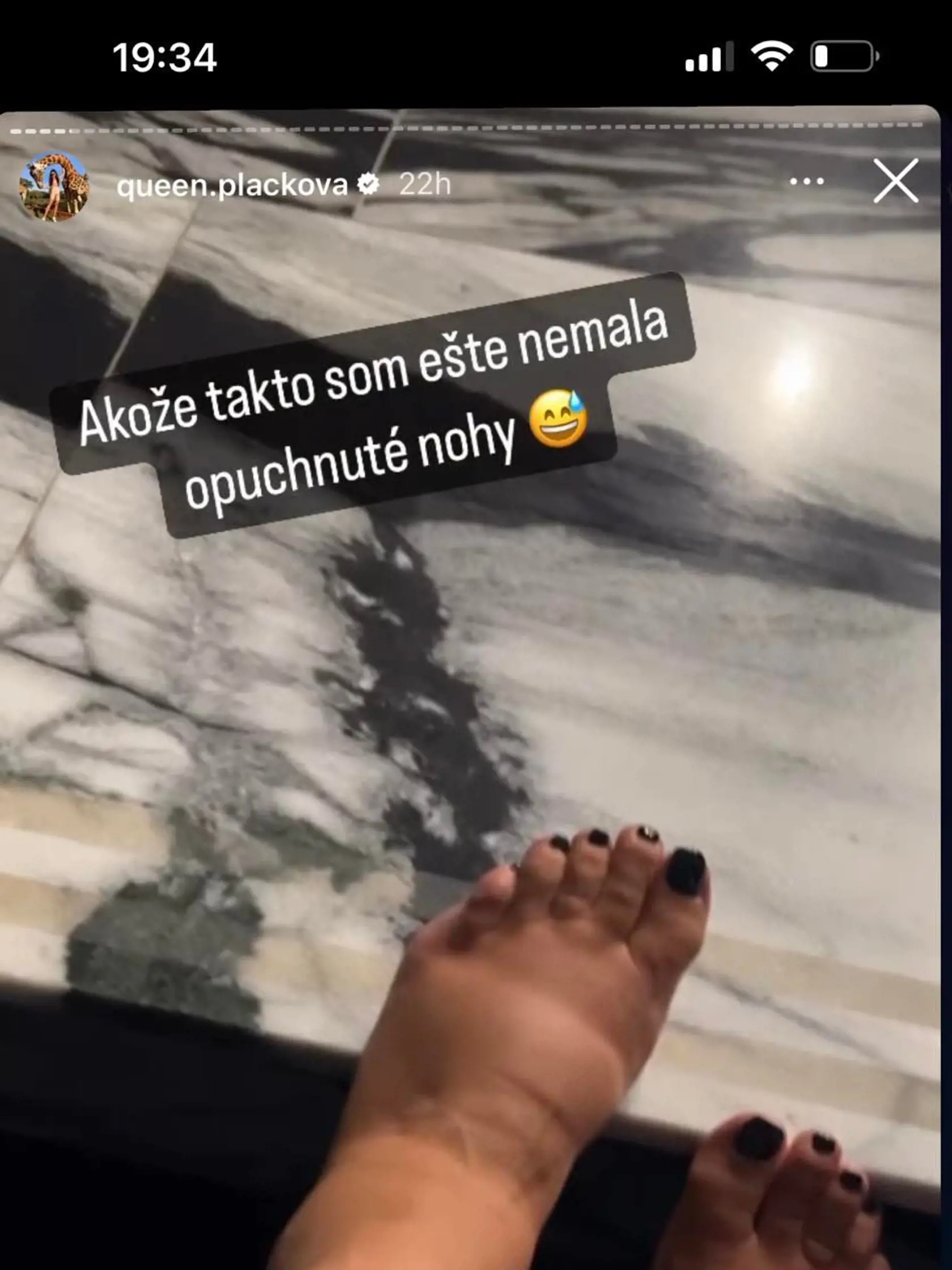 Zuzana Plačková čoskoro rodí a posledné dni sú pre ňu už poriadne náročné.