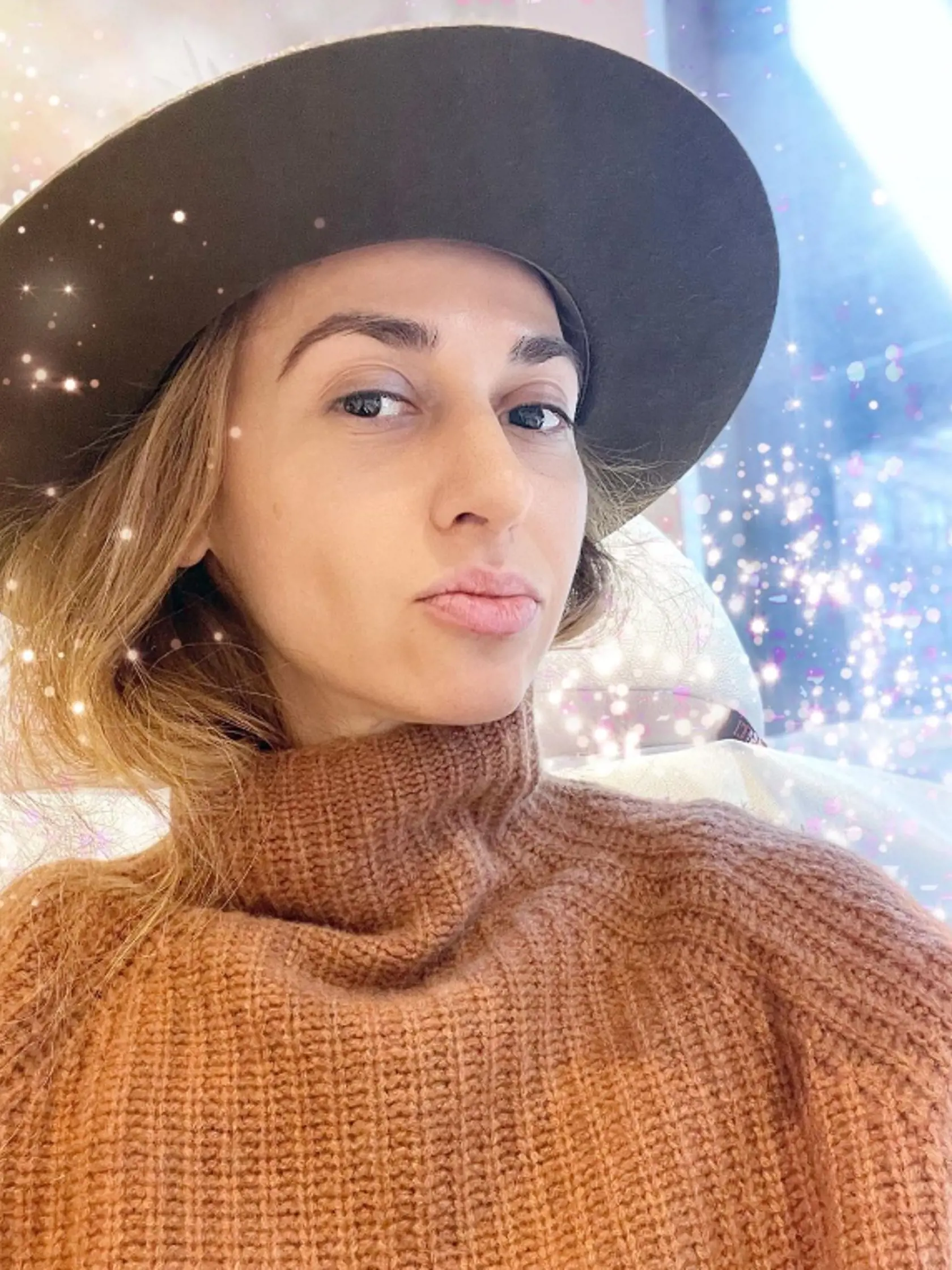 Tanečníčka Vanda Poláková absolvovala rhinoplastiku - estetickú operáciu nosa. Čo hovoríte na tú zmenu?