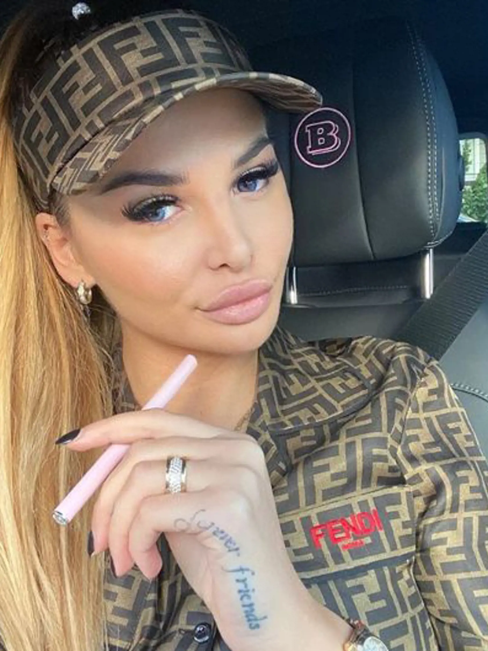 Zuzana Plačková sa netají tým, že sa nechala vylepšiť.