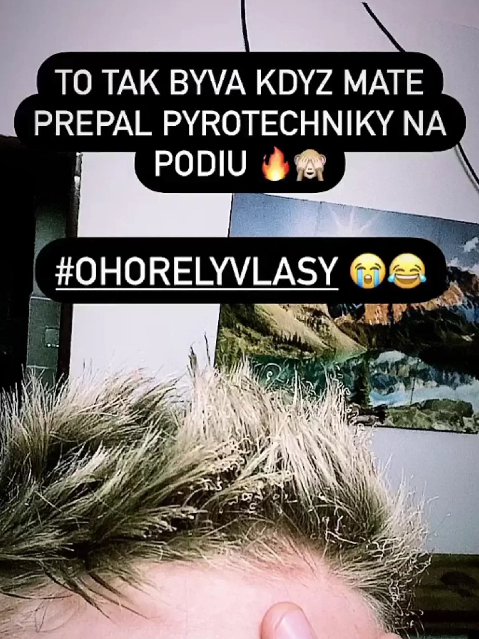 Miro Šmajda si spálil vlasy.